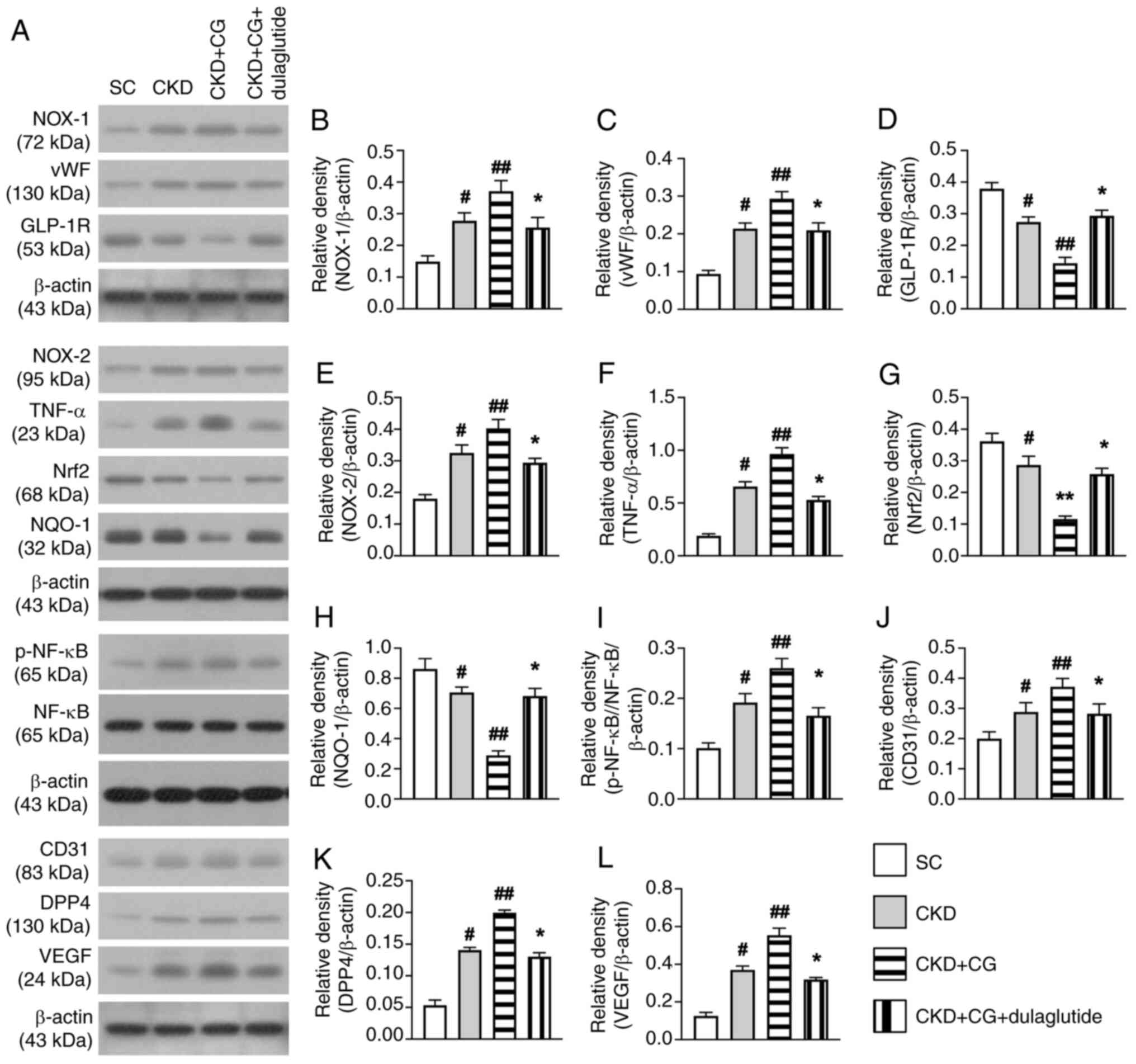 Protein expression levels of
biomarkers of oxidative stress, inflammation and angiogenesis, as
well as DPP4, GLP-1R and antioxidants in the peritonium by day 42
after CKD induction. (A) Protein expression levels were detected by
western blot analysis. Semi-quantification of (B) NOX-1, (C) vWF,
(D) GLP-1R, (E) NOX-2, (F) TNF-α, (G) Nrf2, (H) NQO-1, (I)
p-NF-κB/NF-κB, (J) CD31, (K) DPP4 and (L) VEGF. All statistical
analyses were performed by one-way ANOVA, followed by Bonferroni's
multiple comparisons post hoc test (n=6/group).
#P<0.05, ##P<0.01 vs. SC;
*P<0.05 vs. CKD. CG, chlorhexidine gluconate; CKD,
chronic kidney disease; DPP4, dipeptidyl peptidase 4; GLP-1R,
glucagon-like peptide 1 receptor; NQO-1, NAD(P)H-quinone
oxidoreduc-tase 1; Nrf2, nuclear factor erythroid 2-related factor
2; p-, phosphorylated; SC, sham control; vWF, von Willebrand
factor.