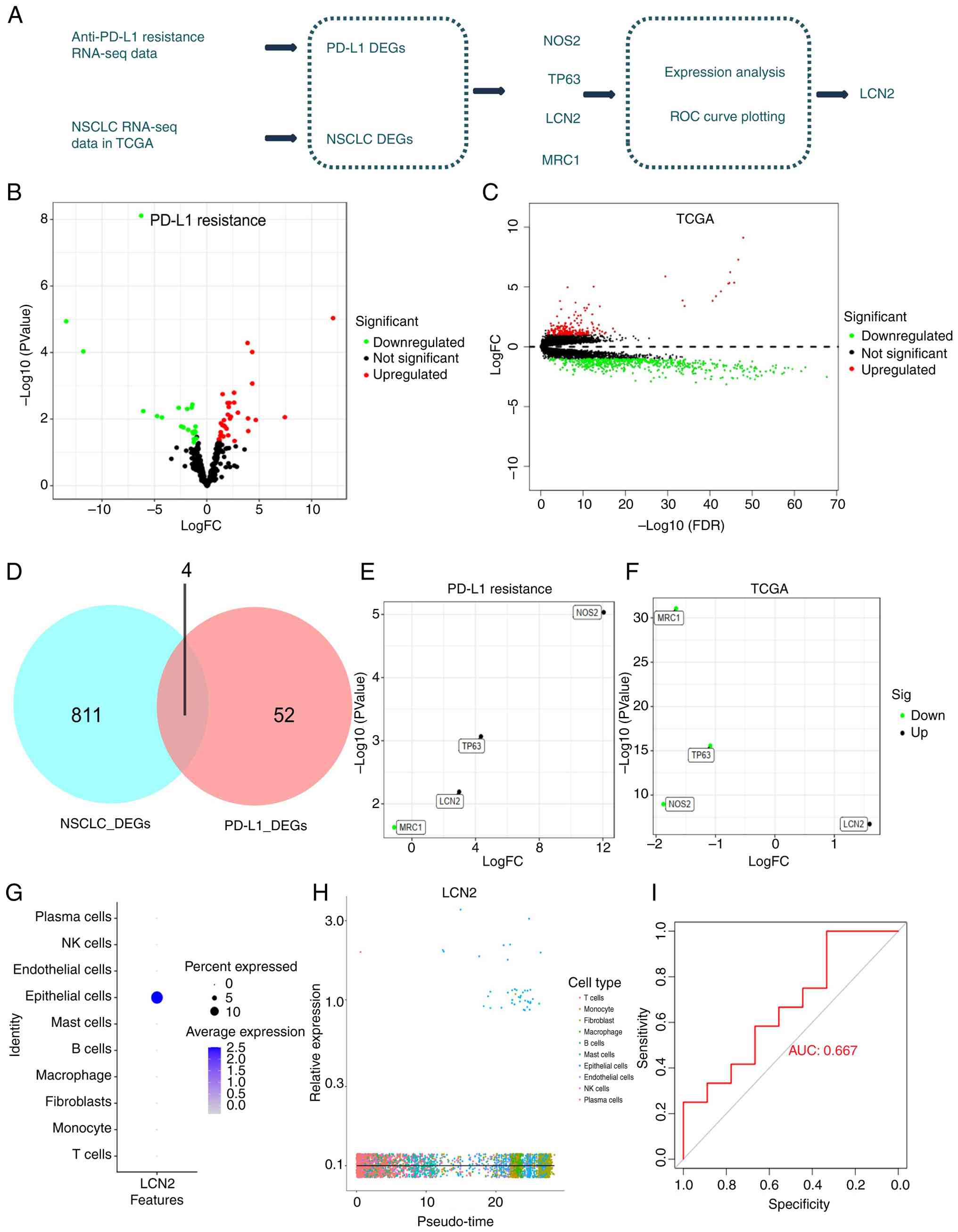Expression of LCN2 in the lung cancer
anti-PD-L1 immunotherapy resistance dataset. (A) Schematic diagram
illustrating the simplified workflow for transcriptome data
analysis from the Gene Expression Omnibus and TCGA databases. (B)
Volcano plot analysis of differential gene expression in the
anti-PD-L1 resistance dataset, where red dots represent
significantly upregulated genes, green dots represent significantly
downregulated genes, and black dots represent genes with no
significant difference. (C) Volcano plot analysis of differential
gene expression in TCGA lung cancer transcriptome data, with red
dots indicating upregulated genes, green dots indicating
downregulated genes, and black dots indicating genes with no
significant difference. (D) Venn diagram analysis comparing DEGs in
NSCLC and anti-PD-L1 resistance DEGs. (E) Volcano plot depicting
the expression of intersecting genes from diagram D in the
anti-PD-L1 resistance transcriptome data, where black dots
represent significantly upregulated genes and green dots represent
significantly downregulated genes. (F) Volcano plot illustrating
the expression of intersecting genes from diagram D in lung cancer
transcriptome data, with black dots representing significantly
upregulated genes and green dots representing significantly
downregulated genes. (G) Expression profile of LCN2 in various cell
subtypes in the scRNA-sequencing data. (H) Trends in LCN2
expression across pseudo-time in the pseudo-time analysis. (I)
Receiver Operating Characteristics curve representing LCN2 in the
anti-PD-L1 resistance transcriptome data. LCN2, lipocalin 2; PD-L1,
programmed death-ligand 1; TCGA, The Cancer Genome Atlas; DEGs,
differentially expressed genes; NSCLC, non-small cell lung cancer;
AUC, area under the curve; ROC, receiver operating characteristic;
FC, fold-change; NK, natural killer; RNA-seq, RNA sequencing.