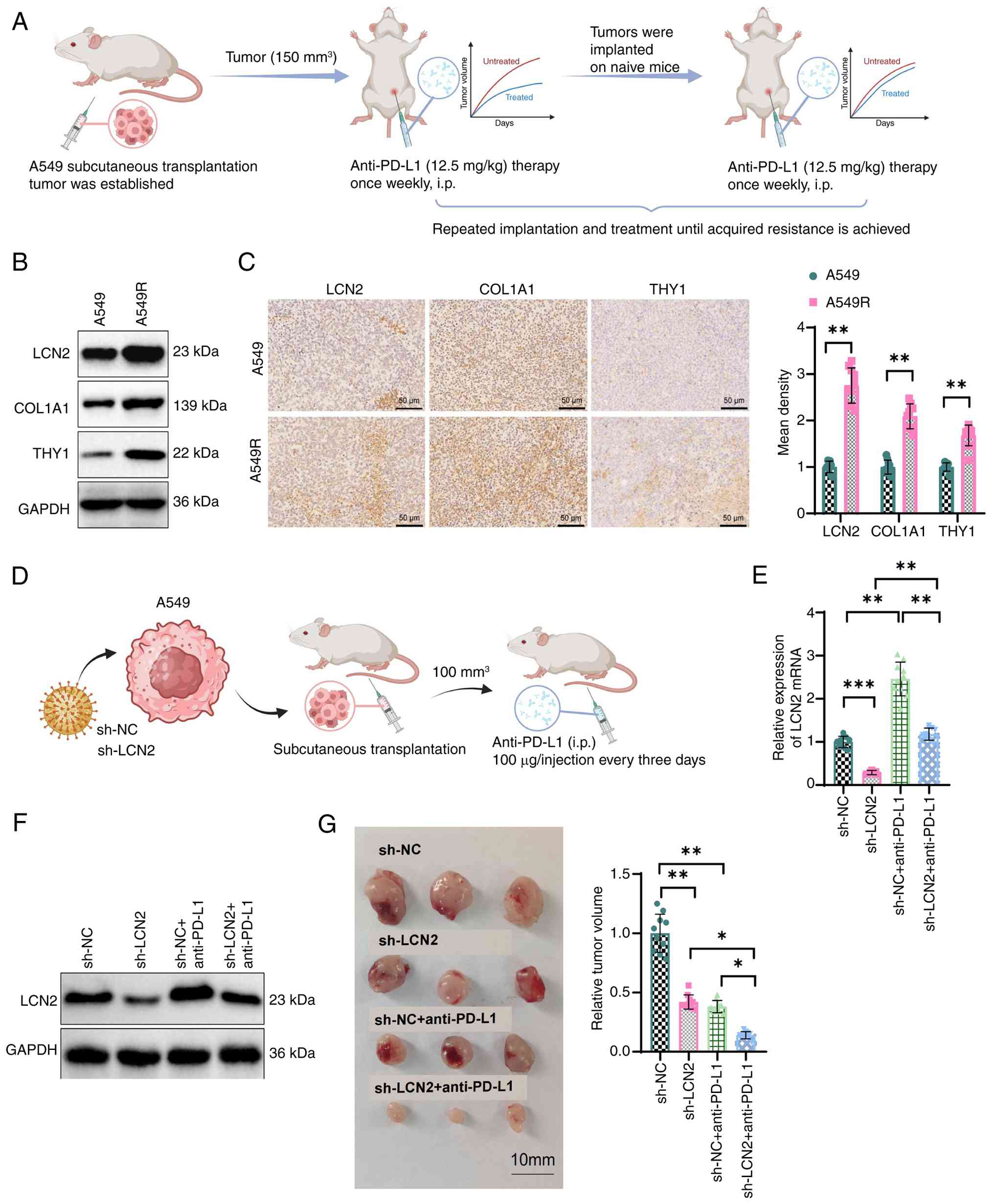 Influence of LCN2 on the growth of
lung cancer in mice. (A) Simplified flowchart outlining the
establishment of an anti-PD-L1 immunotherapy tolerance model in
mice with lung cancer. (B) Western blot analysis of LCN2, COL1A1
and THY1 expression in tumor tissues from drug-resistant and
drug-sensitive mice. (C) Immunohistochemical detection of LCN2,
COL1A1 and THY1 expression in tumor tissues from drug-resistant and
drug-sensitive mice (scale bar, 100 µm). (D) Establishment of a
model for anti-PD-L1 immunotherapy in LCN2-silenced mice. (E)
Evaluation of LCN2 mRNA expression in tumor tissues after LCN2 gene
intervention in mice. (F) Assessment of LCN2 protein expression in
tumor tissues following LCN2 gene intervention in mice. (G) Tumor
size in LCN2 gene intervention mice (n=10 in each group).
*P<0.05, **P<0.01 and ***P<0.001. Unpaired two-tailed
Student's t-test was used for (B) and (C) and one-way ANOVA with
Tukey's multiple comparisons test was used for (E) and (G). LCN2,
lipocalin 2; PD-L1, programmed death-ligand 1; sh-, short hairpin;
NC, negative control; COL1A1, collagen α-1(I) chain; THY1, Thy-1
membrane glycoprotein; i.p., intraperitoneal.