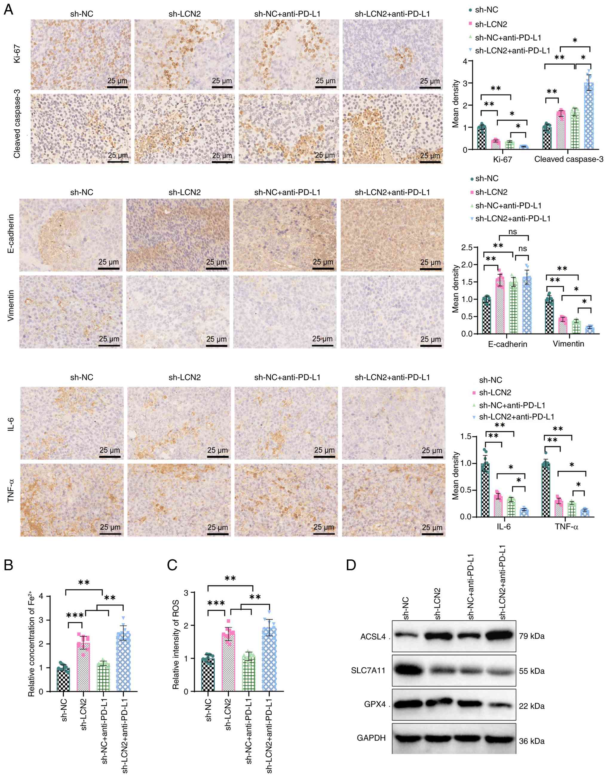 Impact of LCN2 on proliferation,
invasion and inflammatory infiltration in mouse lung cancer cells.
(A) Immunohistochemical analysis of Ki-67, cleaved caspase 3,
E-cadherin, Vimentin, IL-6 and TNF-α expression in mouse tumor
tissues (scale bar, 20 µm). (B) Evaluation of intratumoral
Fe2+ levels. (C) Measurement of intratumoral ROS levels.
(D) Detection of ferroptosis-related proteins ACSL4, SLC7A11 and
GPX4 expression in tissues. *P<0.05, **P<0.01 and
***P<0.001. One-way ANOVA with Tukey's multiple comparisons test
was used for (A-C). LCN2, lipocalin 2; sh-, short hairpin; NC,
negative control; PD-L1, programmed death-ligand 1; ROS, reactive
oxygen species; Fe2+, iron; ns, not significant
(P>0.05); ACSL4, acyl-CoA synthetase long-chain family member 4;
SLC7A11, solute carrier family 7 member 11; GPX4, glutathione
peroxidase 4.