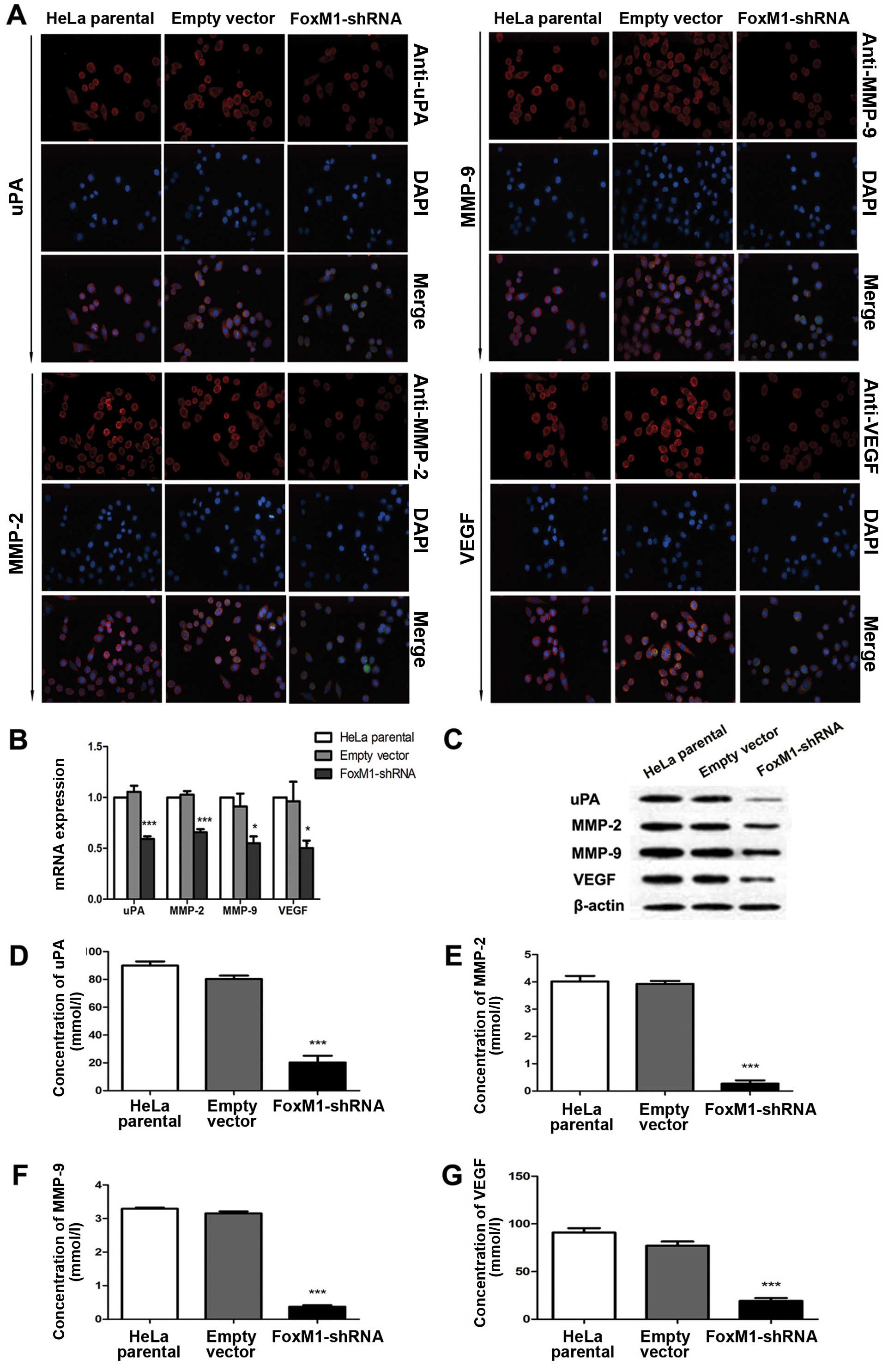 Downregulation Of Foxm1 Inhibits Proliferation Invasion And Angiogenesis Of Hela Cells In Vitro And In Vivo
