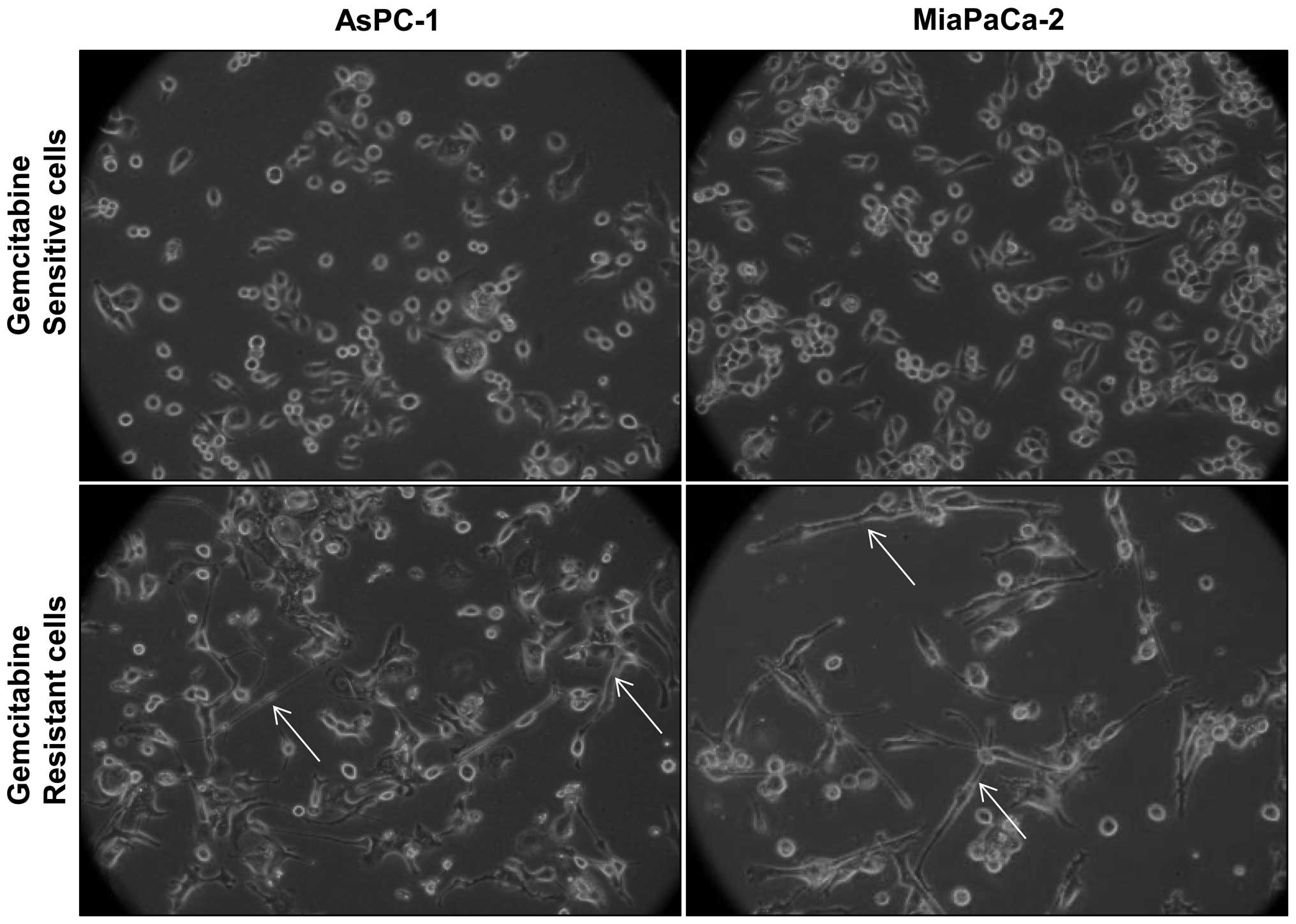 Bitter Melon Juice Targets Molecular Mechanisms Underlying Gemcitabine Resistance In Pancreatic Cancer Cells
