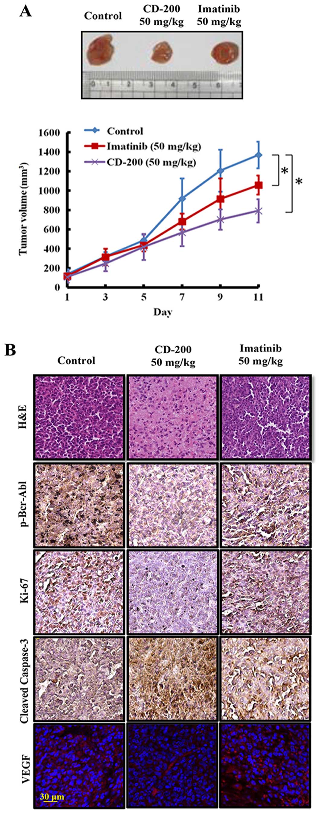 Imatinib Mesylate Inhibits Leydig Cell Tumor Growth 