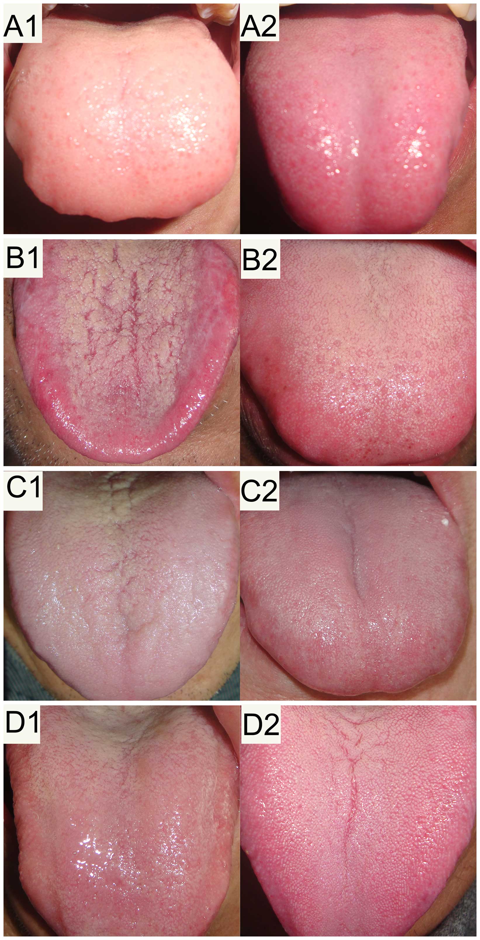 Traditional Chinese Medicine Tongue Chart