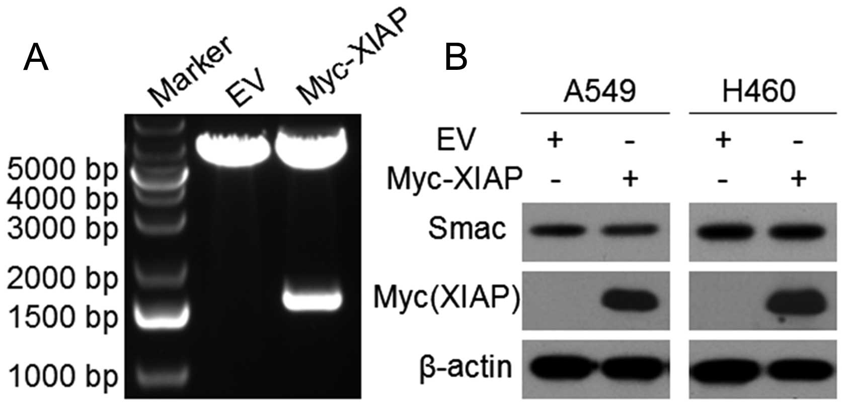 XIAP inhibits mature Smac-induced apoptosis by degrading 