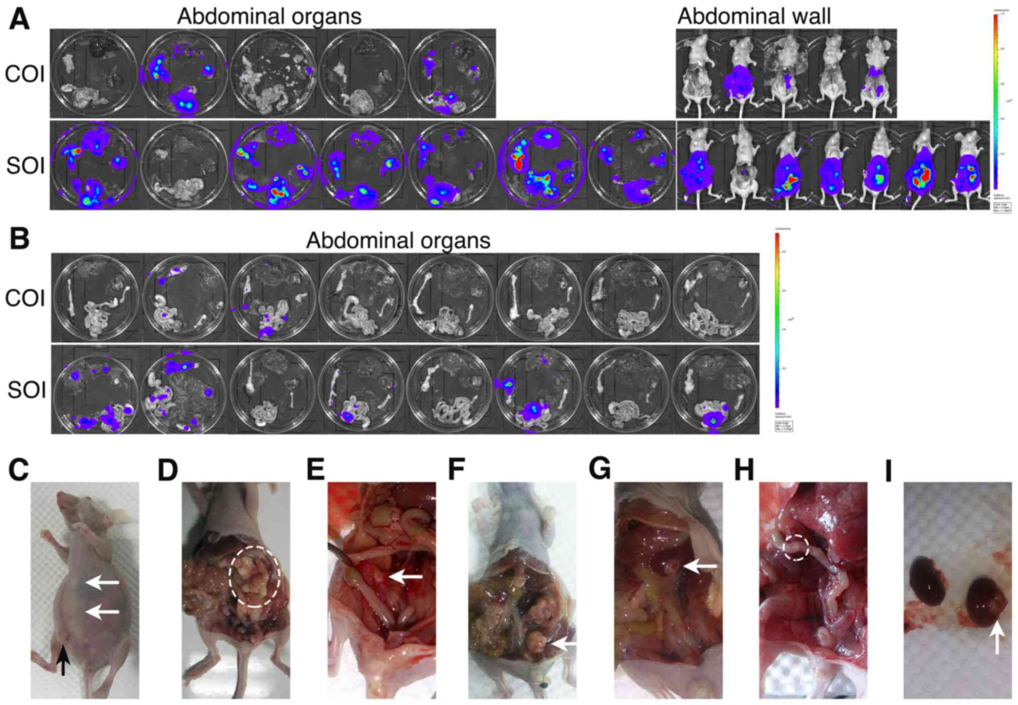 ovarian cancer xenografts mice