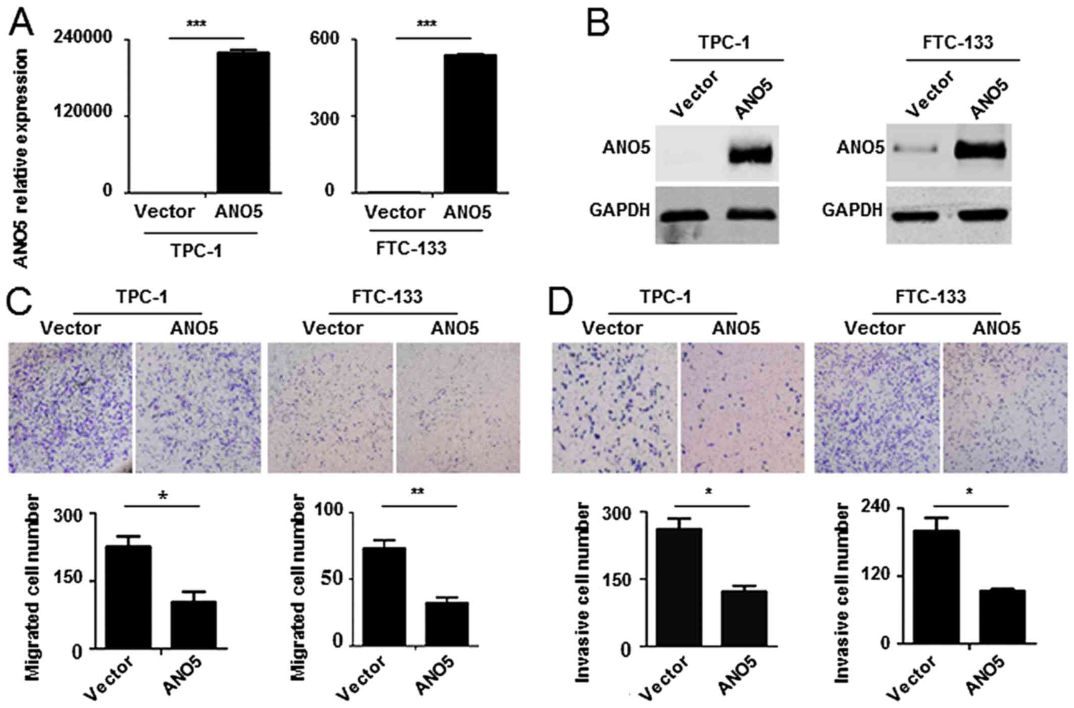 Anoctamin5 regulates cell migration and invasion in thyroid cancer