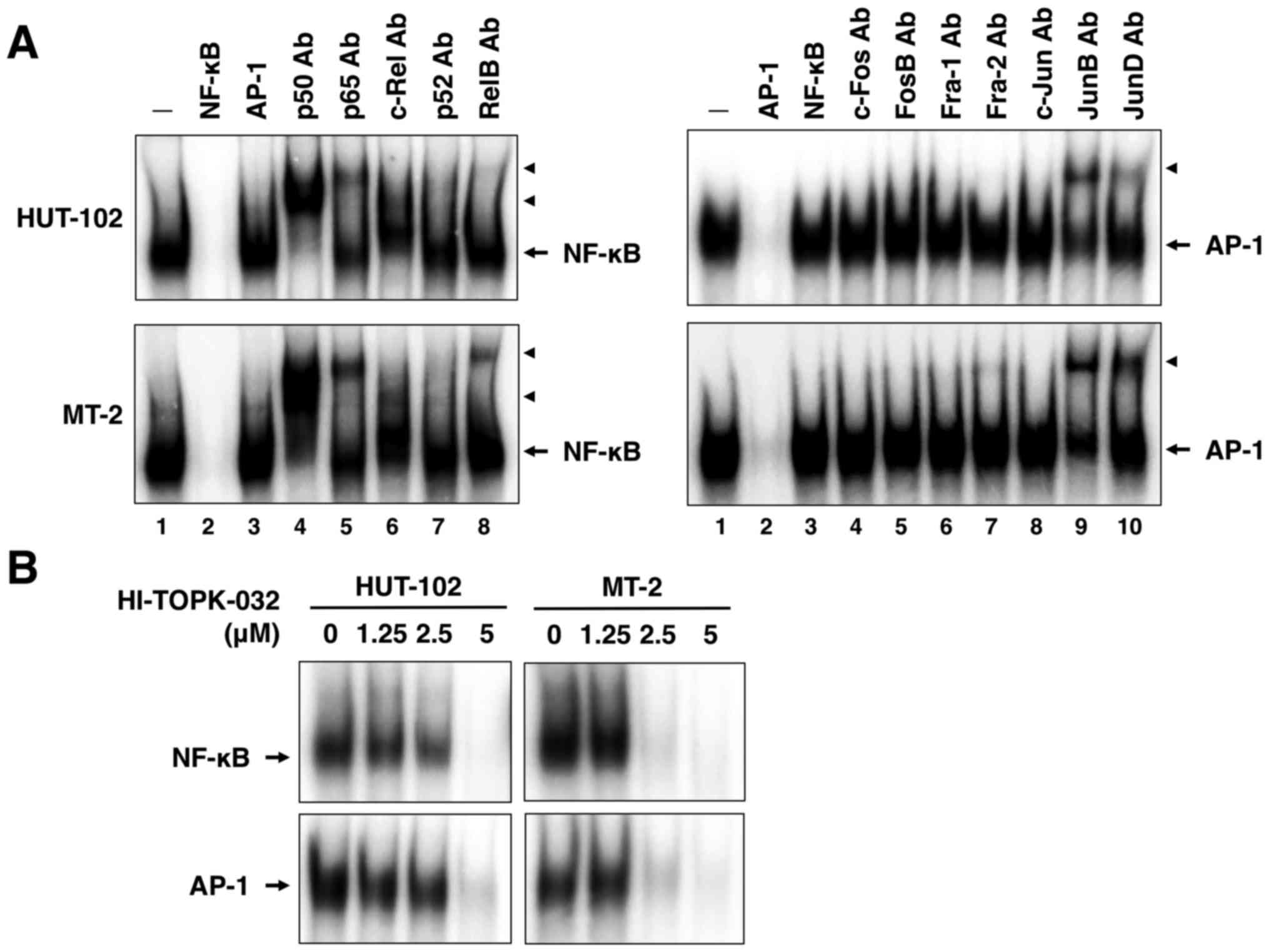 Mitotic kinase PBK/TOPK as a therapeutic target for adult T‑cell 