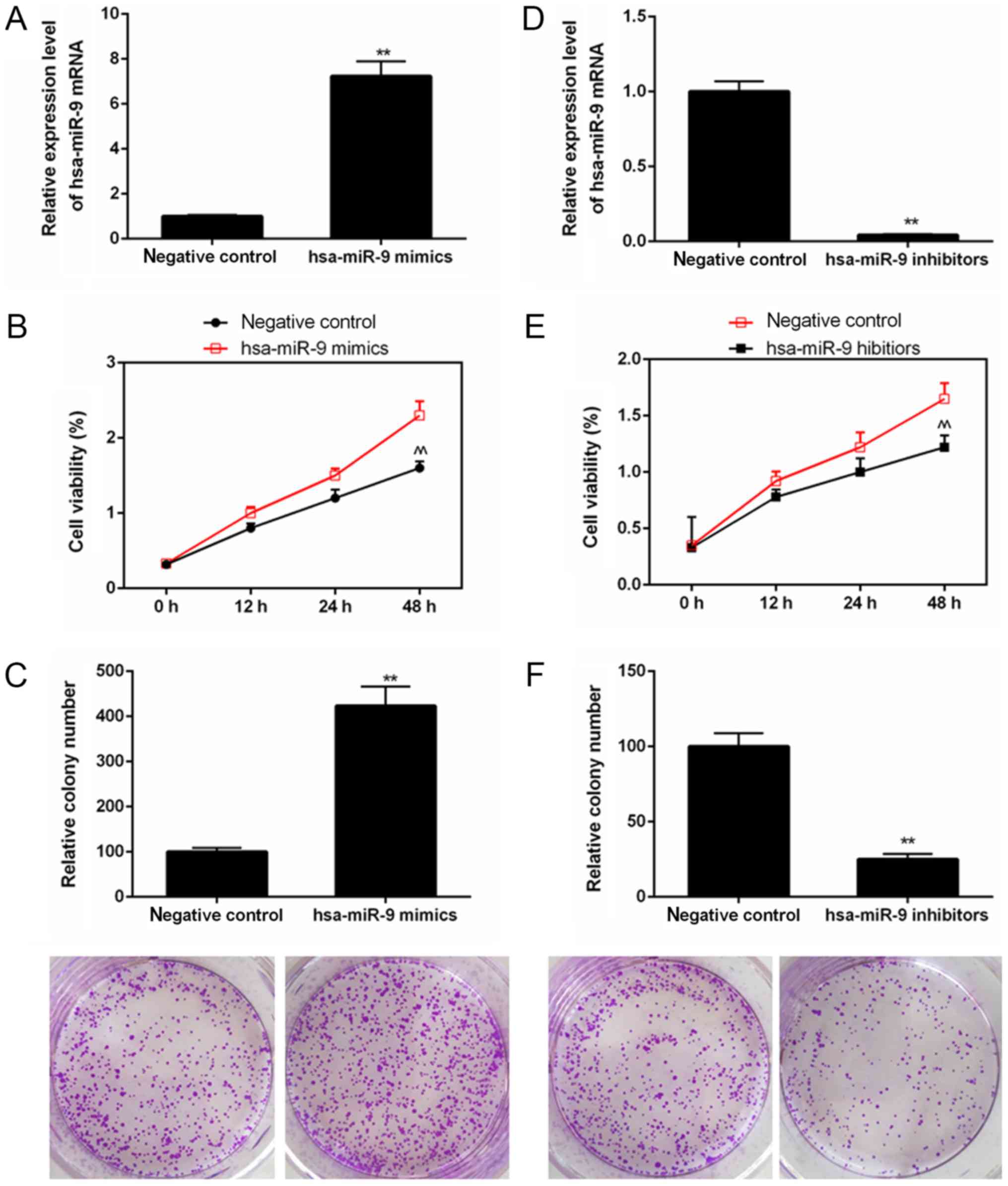 miR‑9 depletion suppresses the proliferation of osteosarcoma cells 