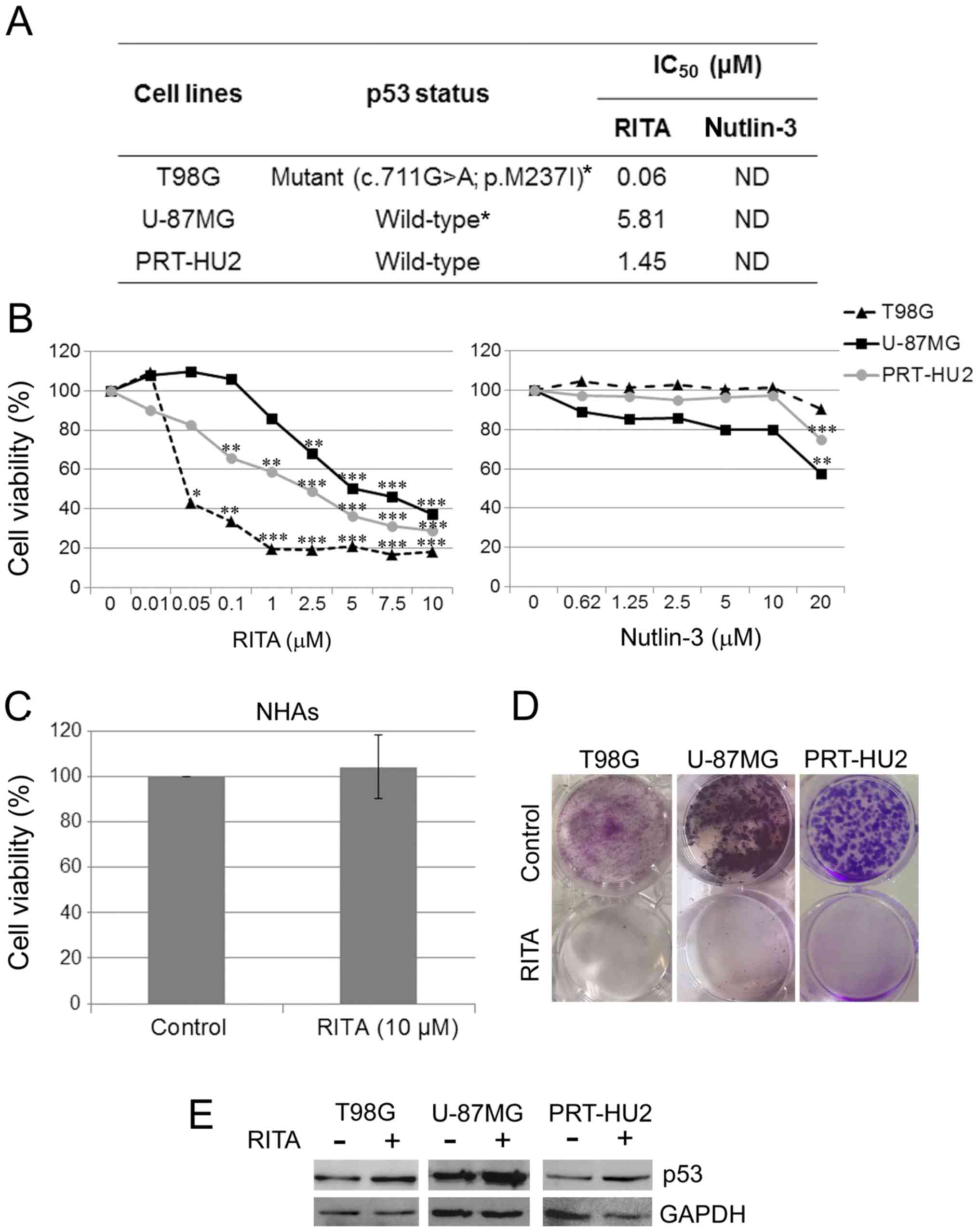 can lung cancer be misdiagnosed as tuberculosis