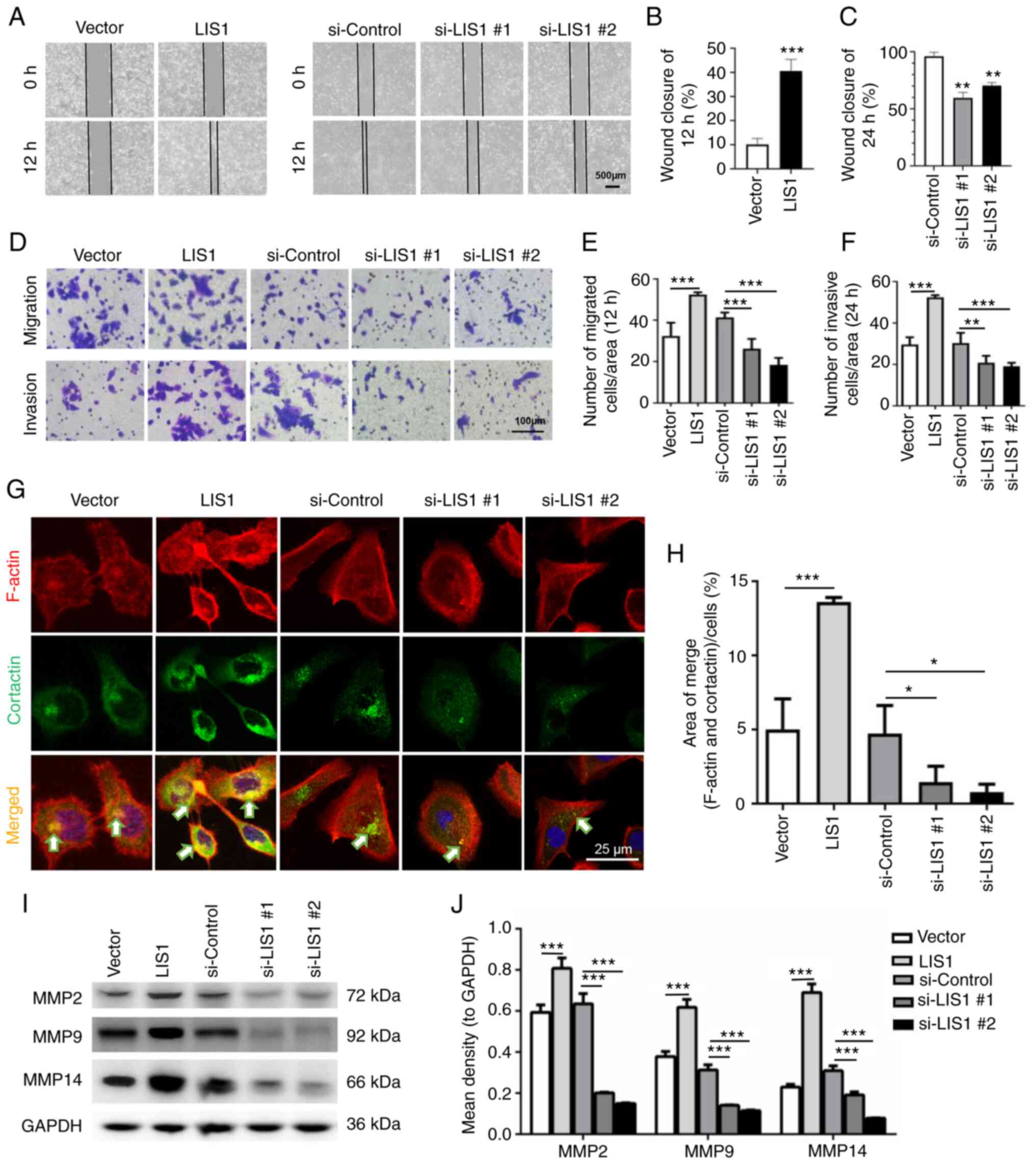 Lis1 Interacts With Clip170 To Promote Tumor Growth And Metastasis Via The Cdc42 Signaling