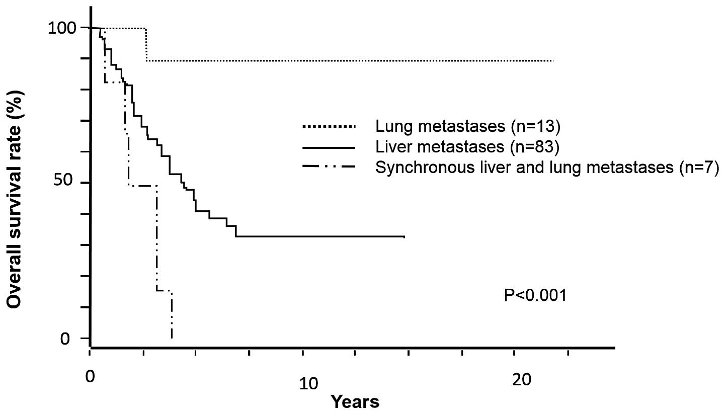 metastatic cancer colon survival rate