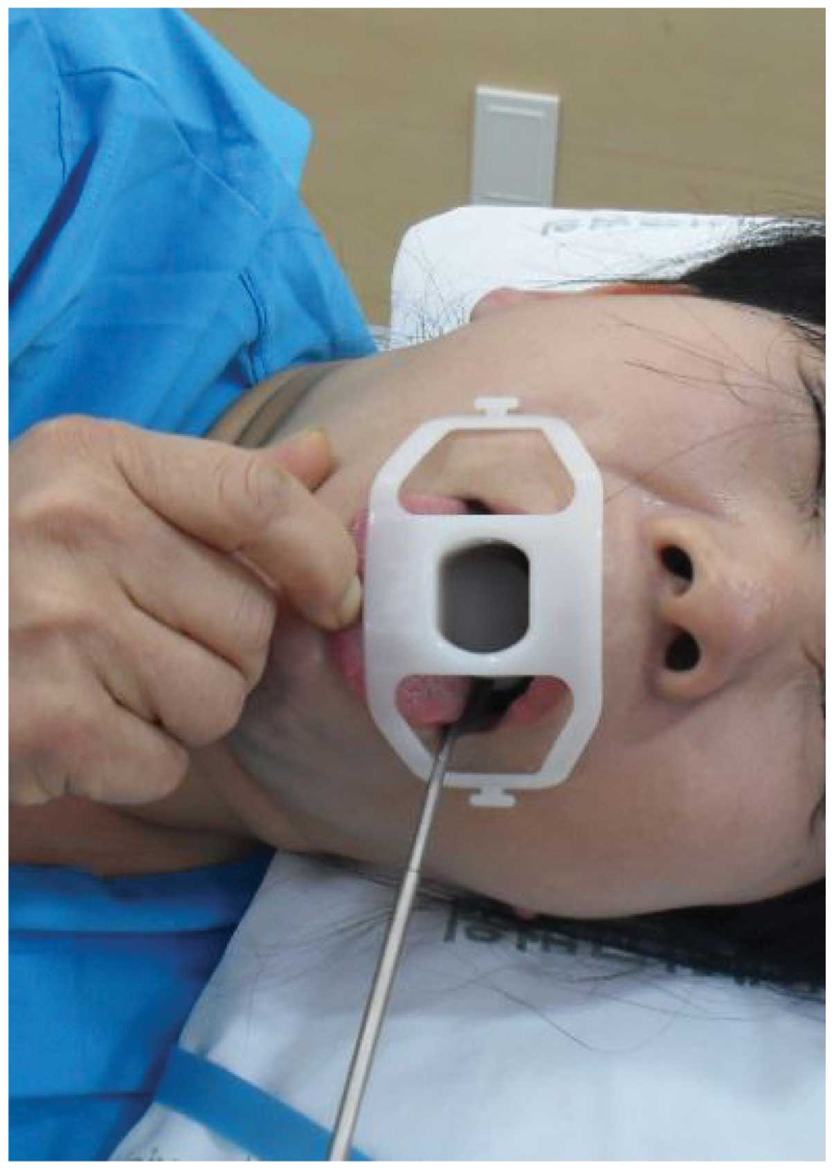 Highdose rate brachytherapy for local recurrent adenoid cystic