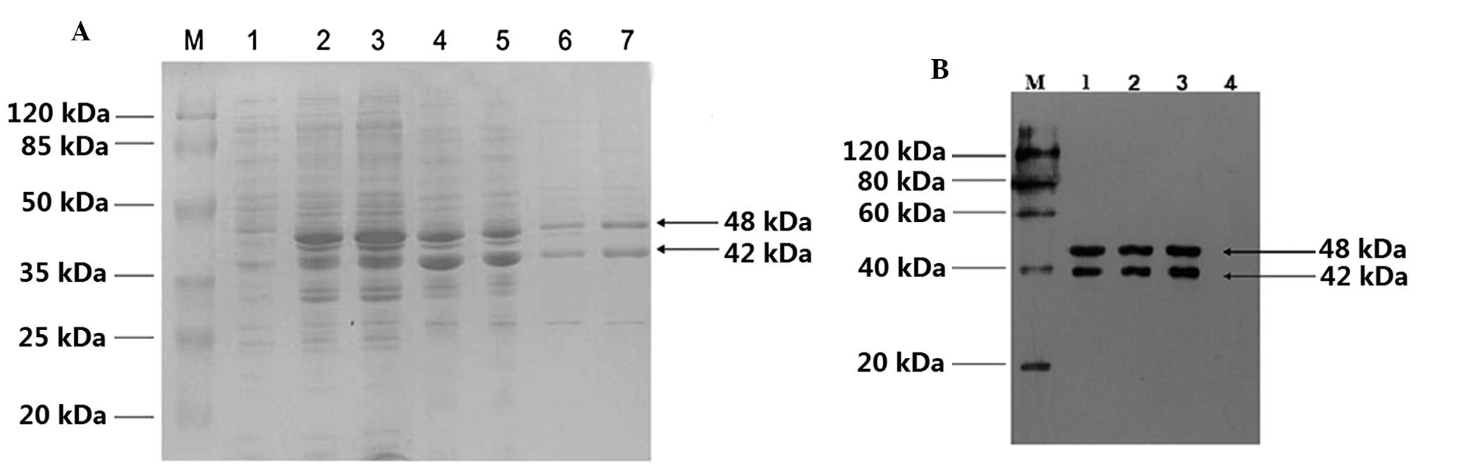 Full article: Intranasal and Intramuscular Immunization with Outer Membrane  Vesicles from Serogroup C Meningococci Induced Functional Antibodies and  Immunologic Memory