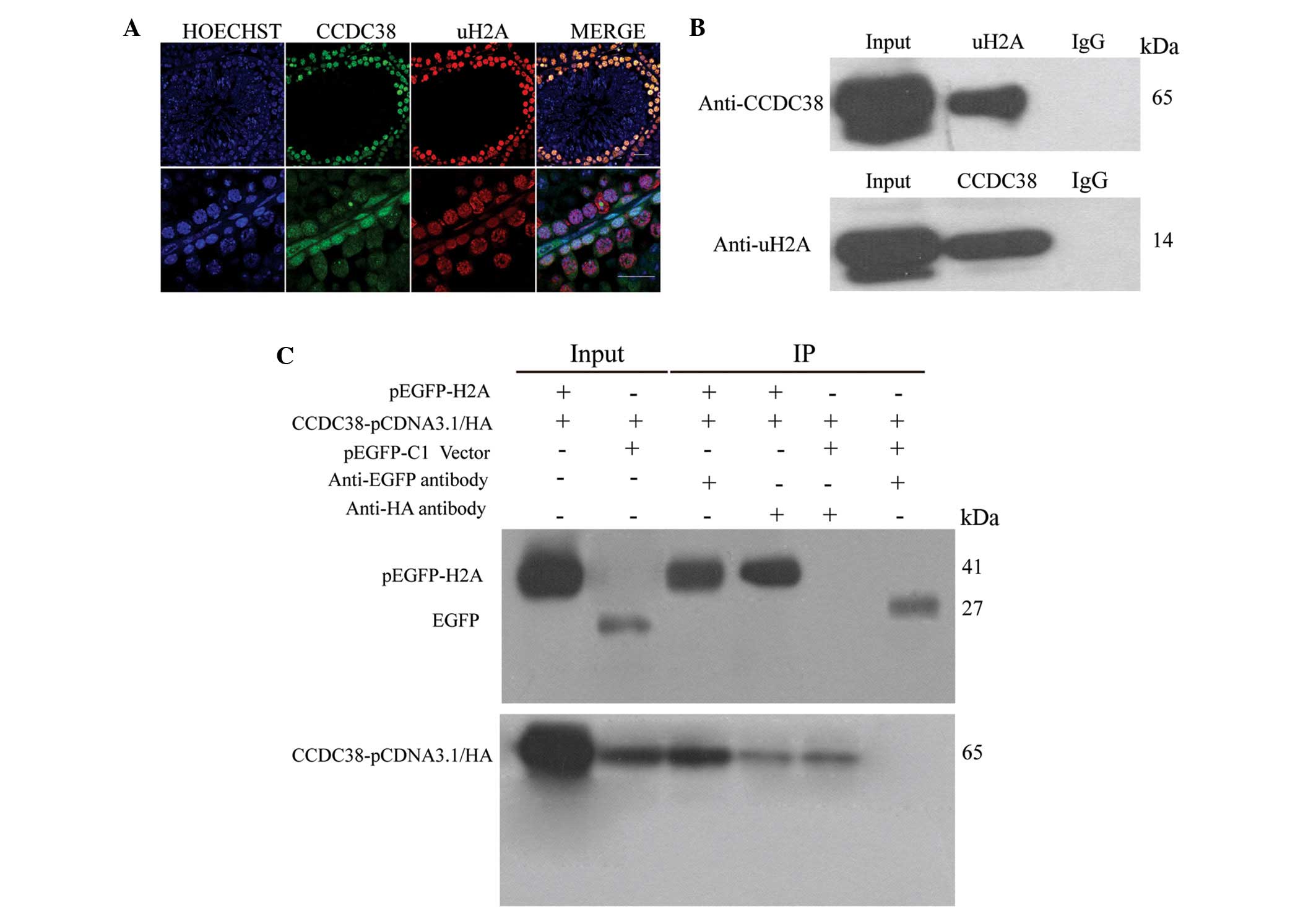 UBR2 mediates transcriptional silencing during spermatogenesis via histone  ubiquitination