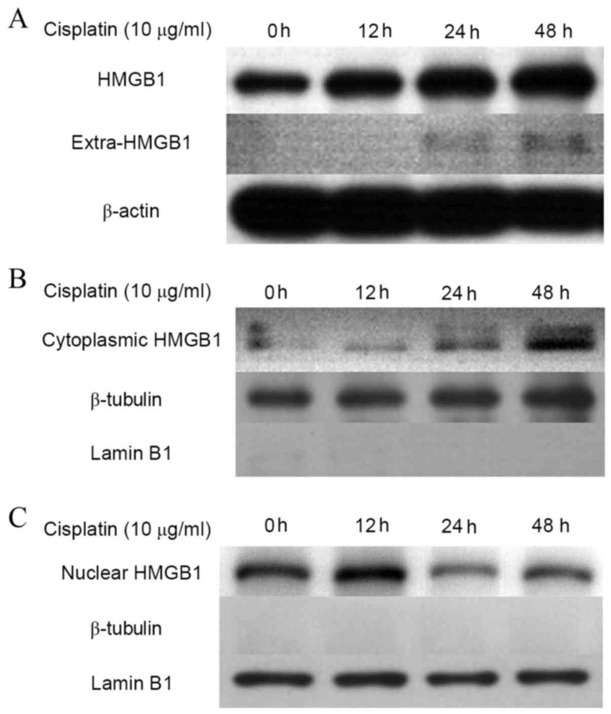 Degradation of HMGB1 and PARP-1 in HeLa cells after infection with C.