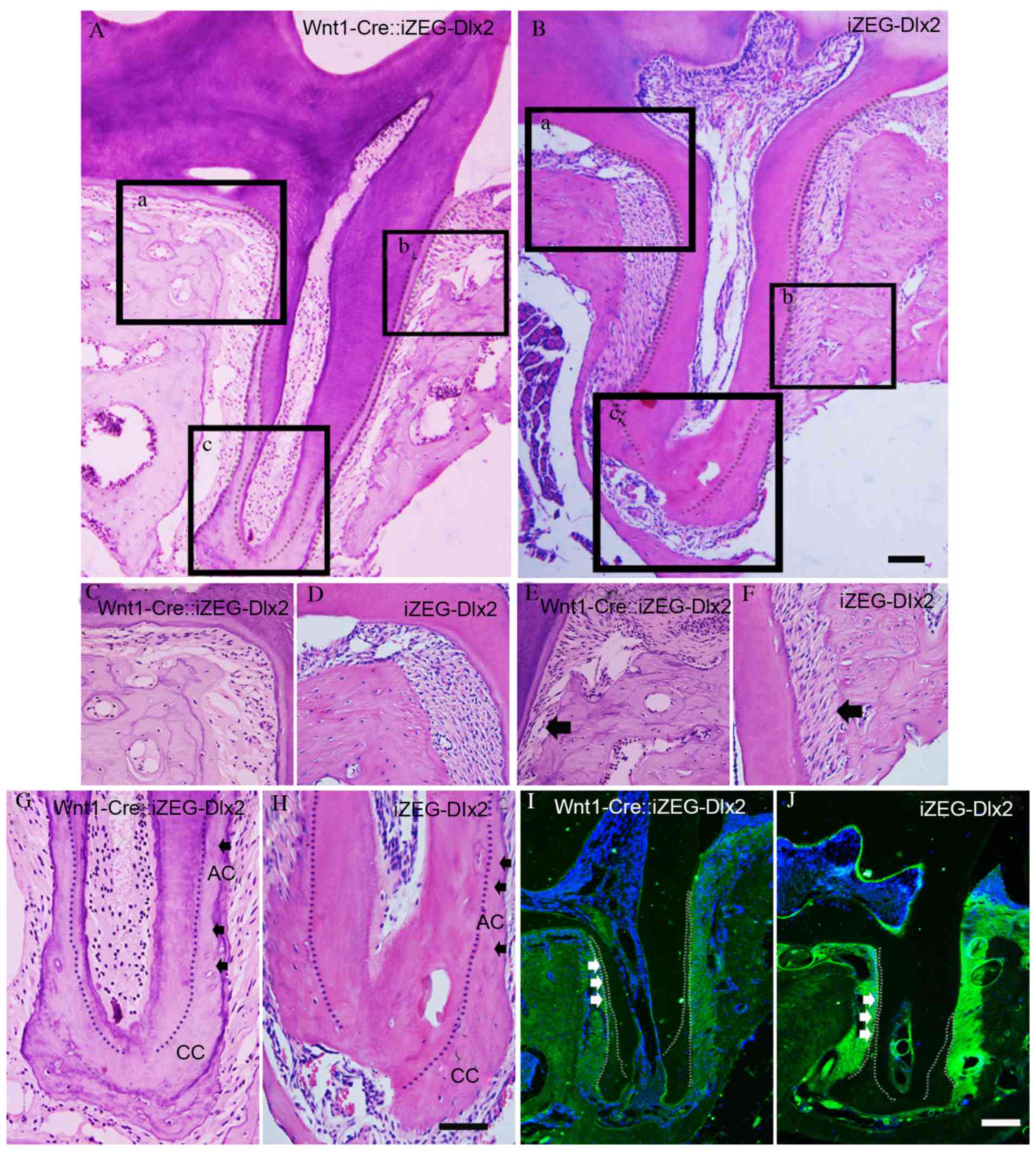 Dental and periodontal phenotypes of Dlx2 overexpression in mice