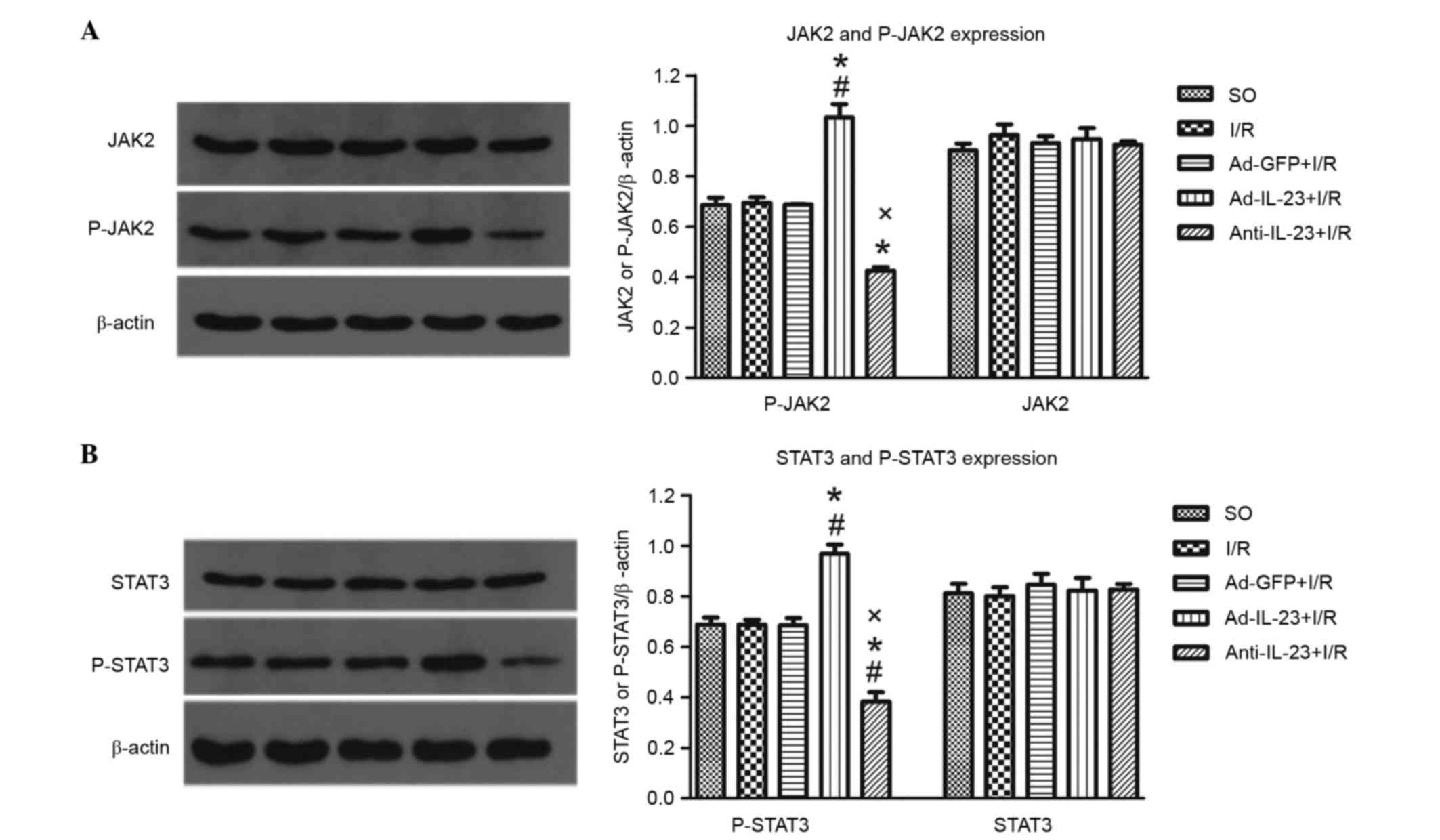 Promoting Effects Of Il 23 On Myocardial Ischemia And Reperfusion Are Associated With Increased Expression Of Il 17a And Upregulation Of The Jak2 Stat3 Signaling Pathway