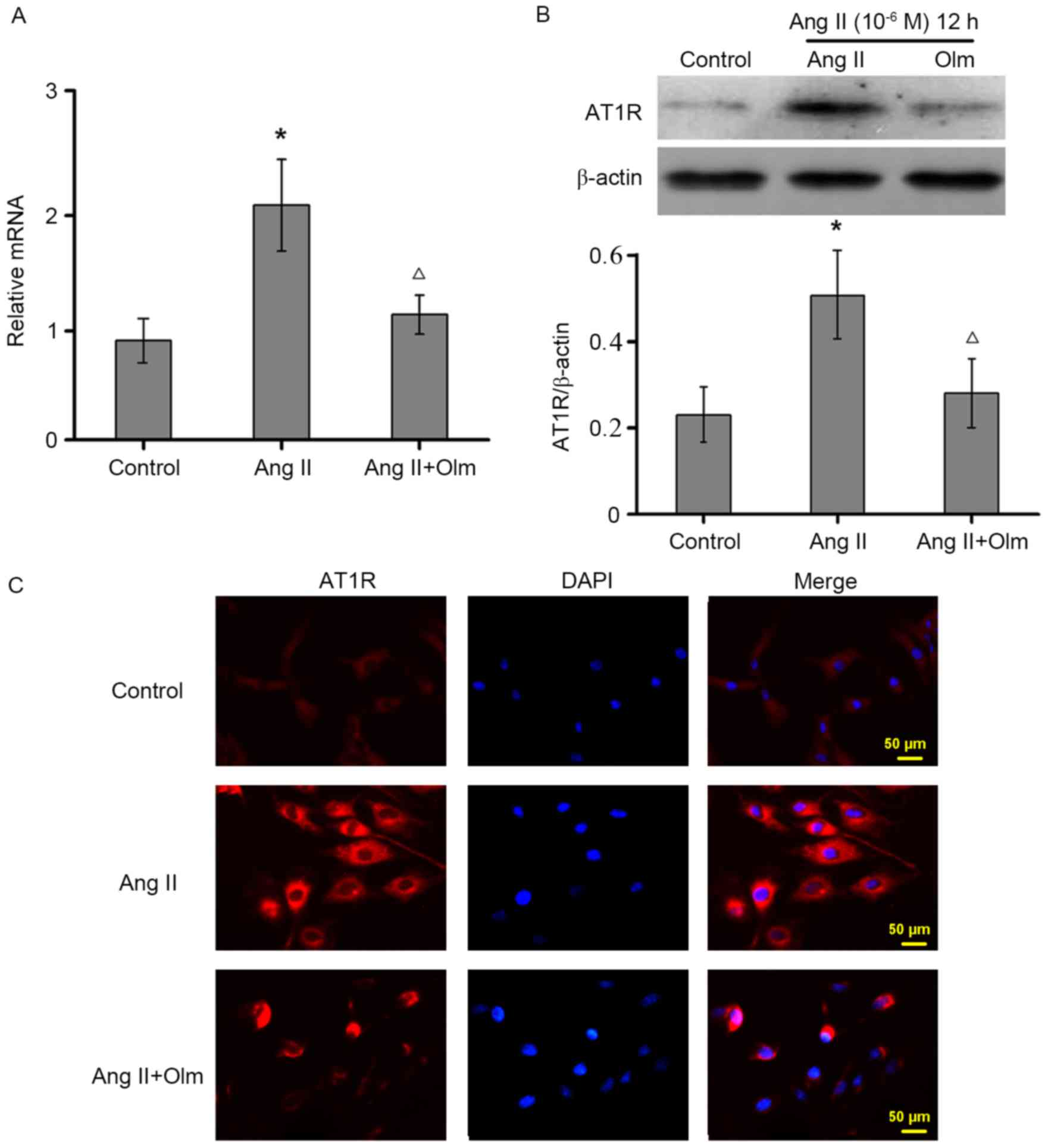 Rho-Kinase Mediates Angiotensin II-Induced Monocyte Chemoattractant  Protein-1 Expression in Rat Vascular Smooth Muscle Cells