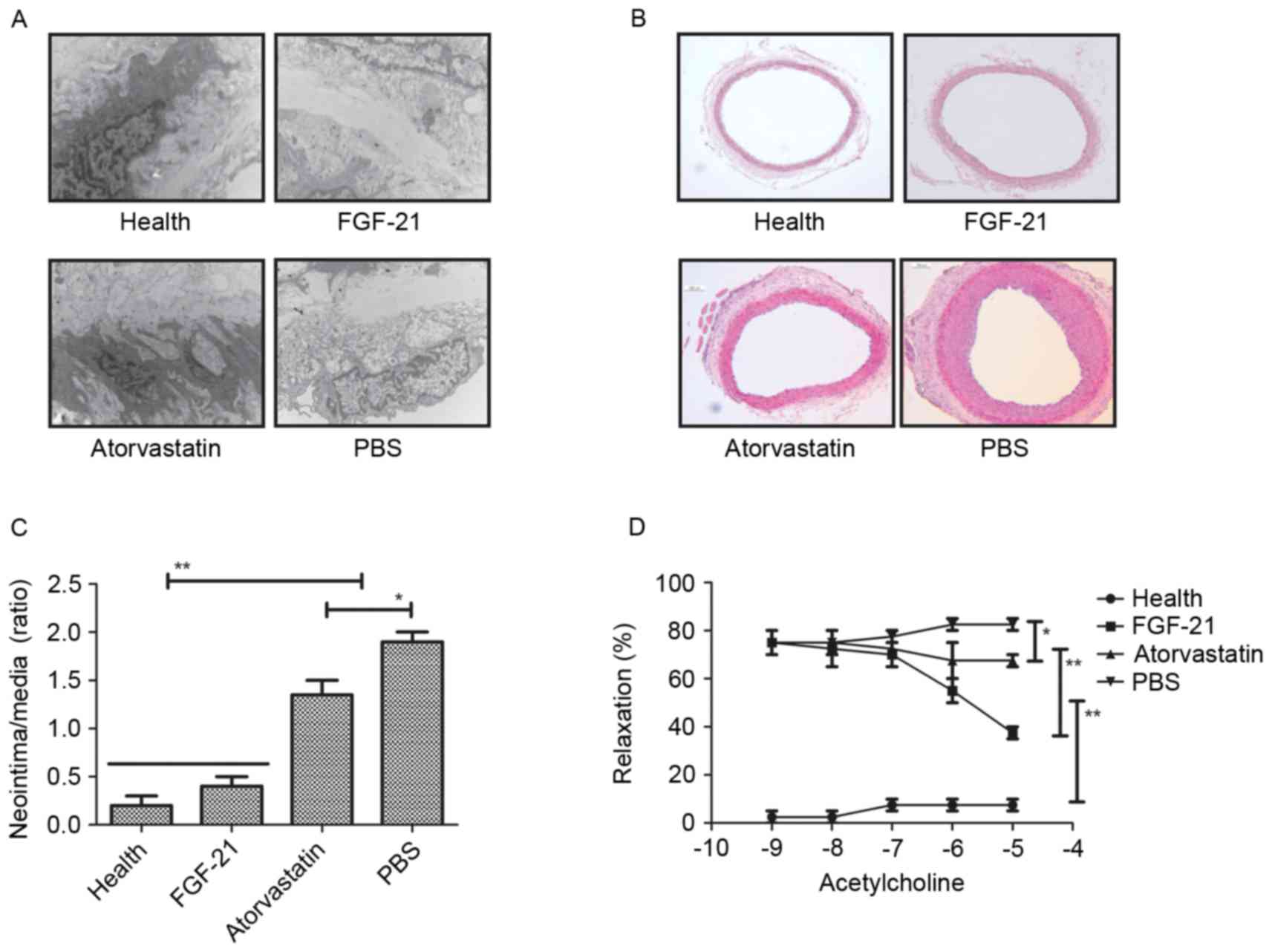 Therapeutic Effects Of Fibroblast Growth Factor 21 Against Atherosclerosis Via The Nf Kb Pathway