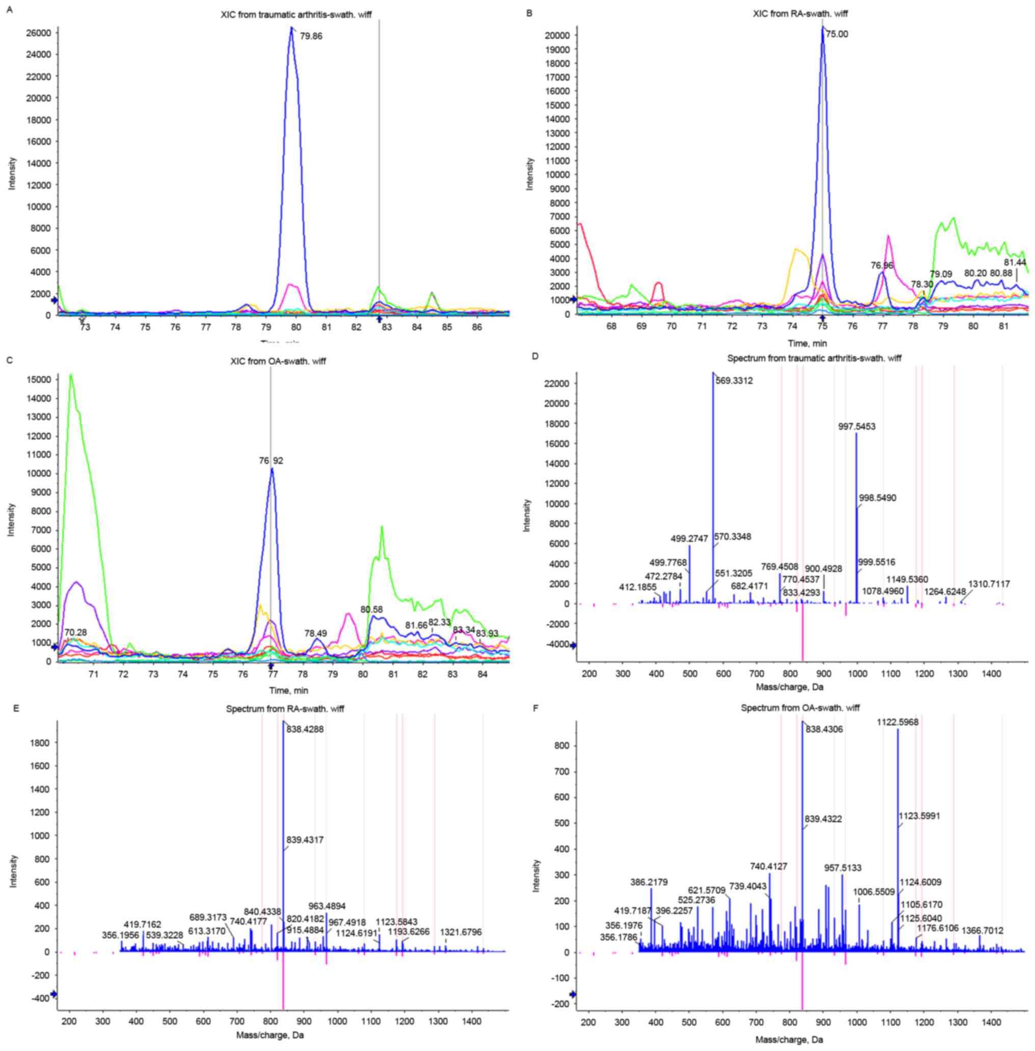 Synovial Fluid Analysis Chart