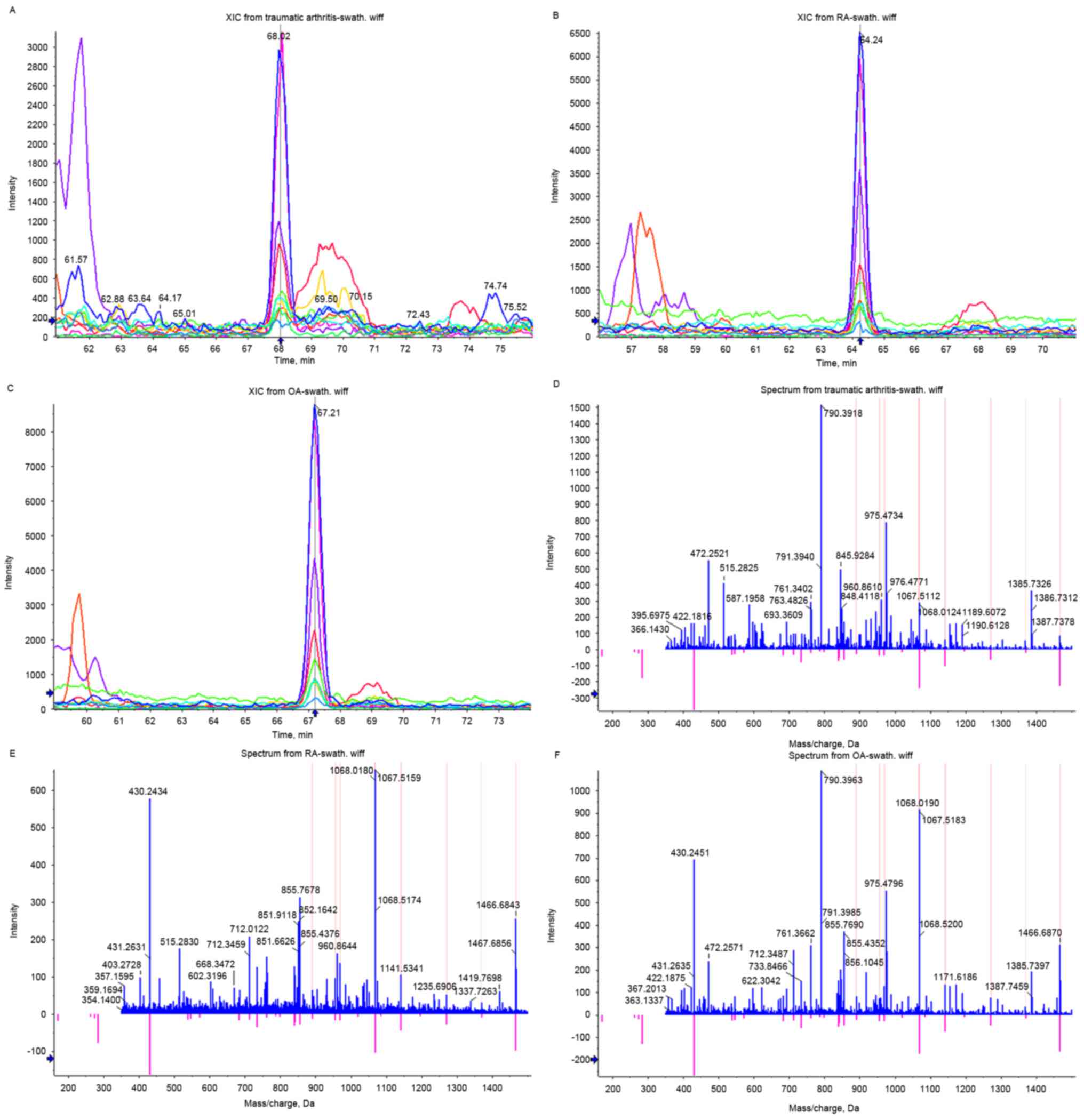 Synovial Fluid Analysis Chart