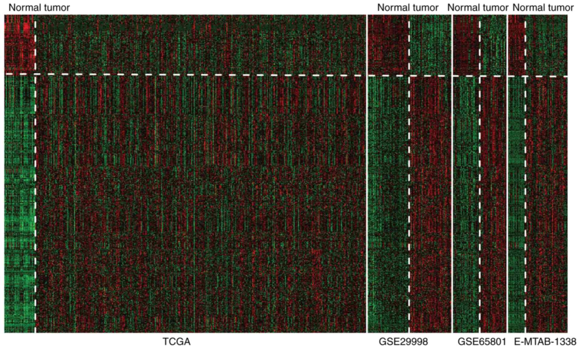 LASSO‑based Cox‑PH model identifies an 11‑lncRNA signature for 