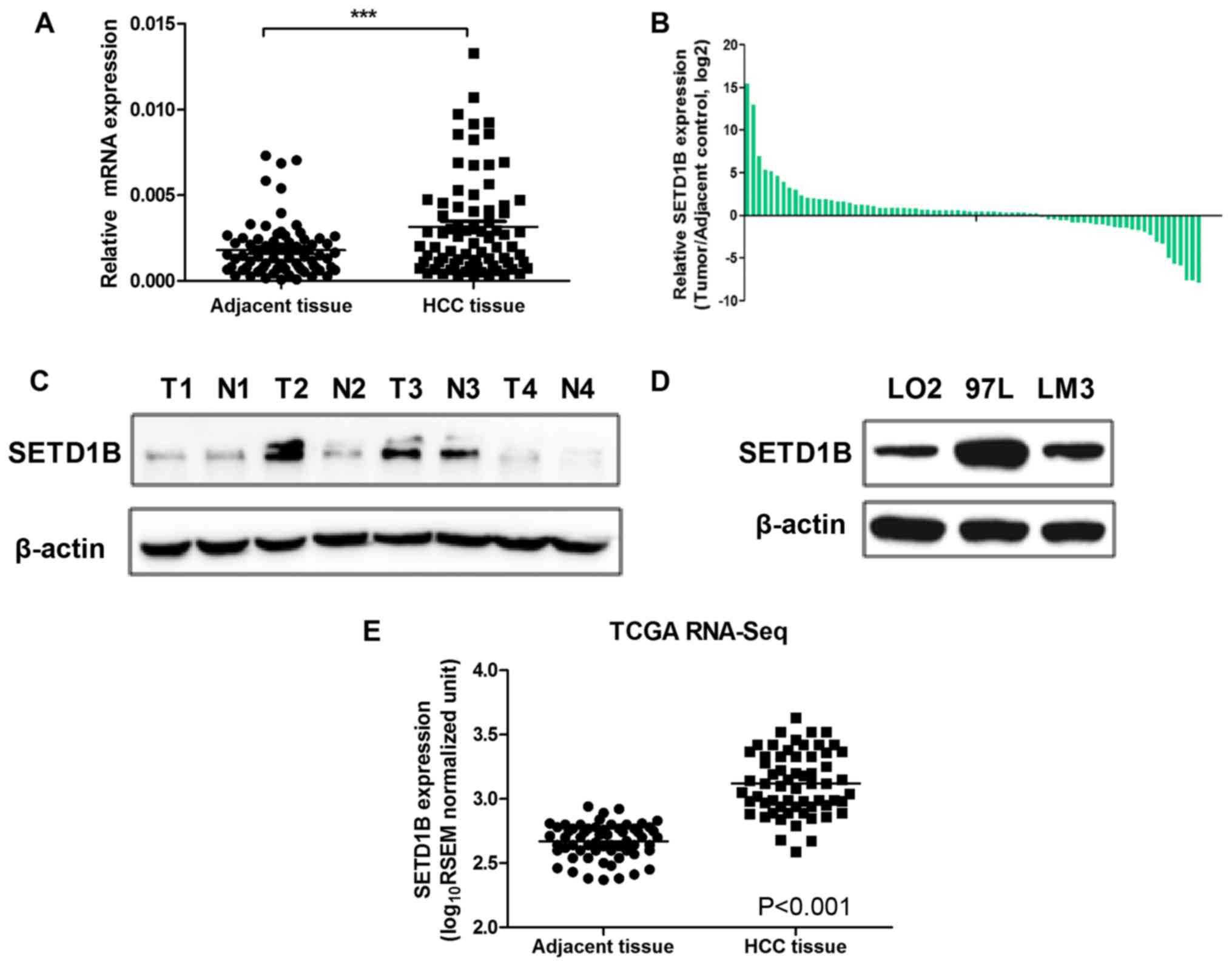 Histone methyltransferases Setd1b increases H3K4me3 level to