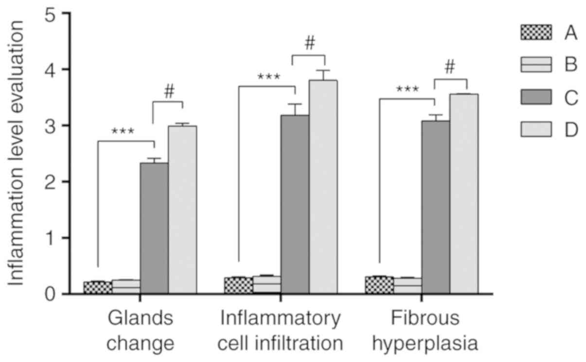 nonbacterial prostatitis and alcohol Prosztata a jeleit úgy néz ki