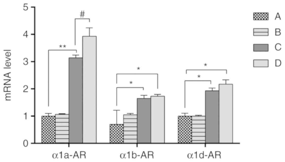 prostatitis and alcohol consumption)