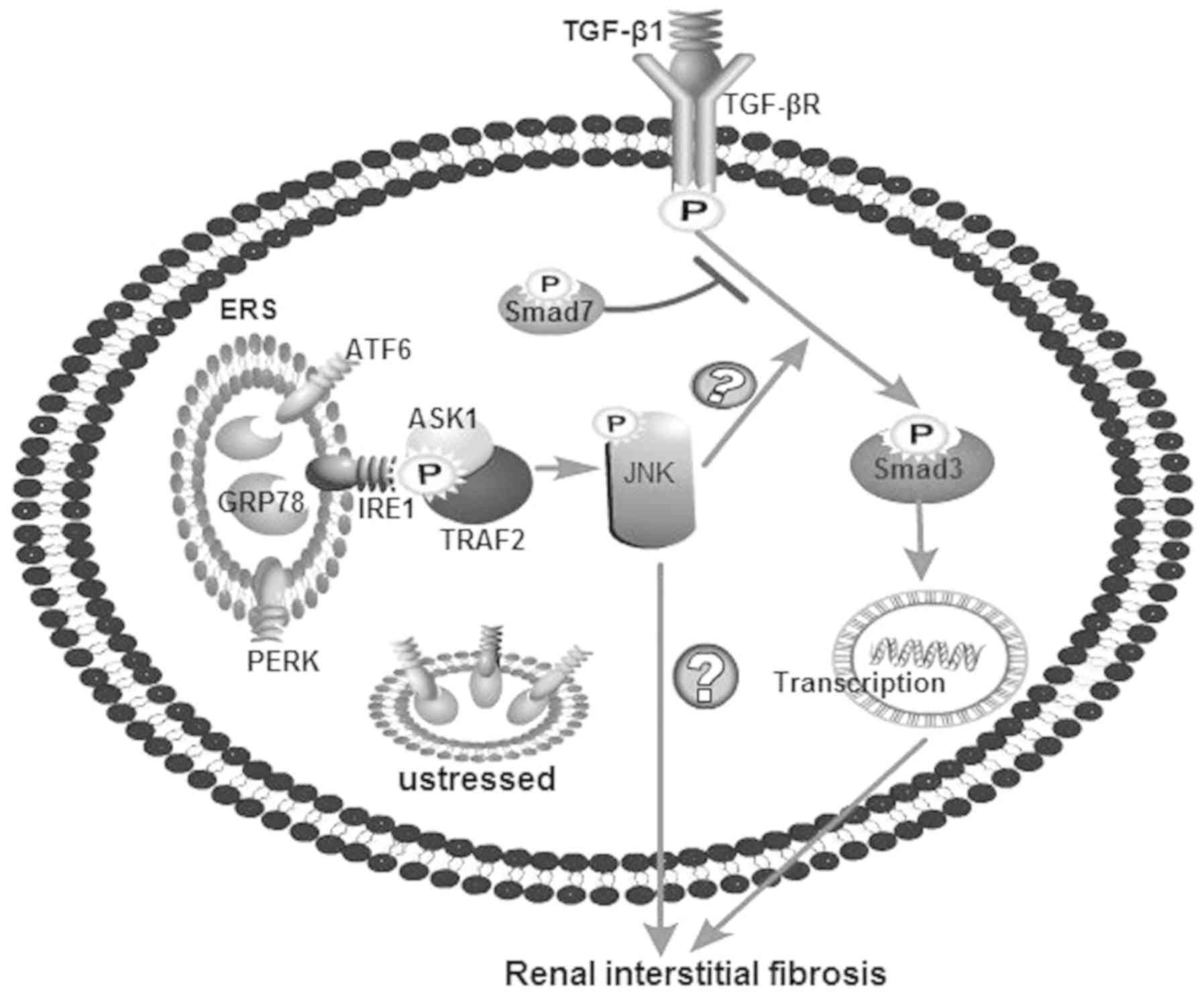 Molecular MedicineReportsc‑Jun N‑terminal kinase/transforming growth factor‑β/Smad3 pathway: Is it associated with endoplasmic reticulum stress‑mediated renal interstitial fibrosis?