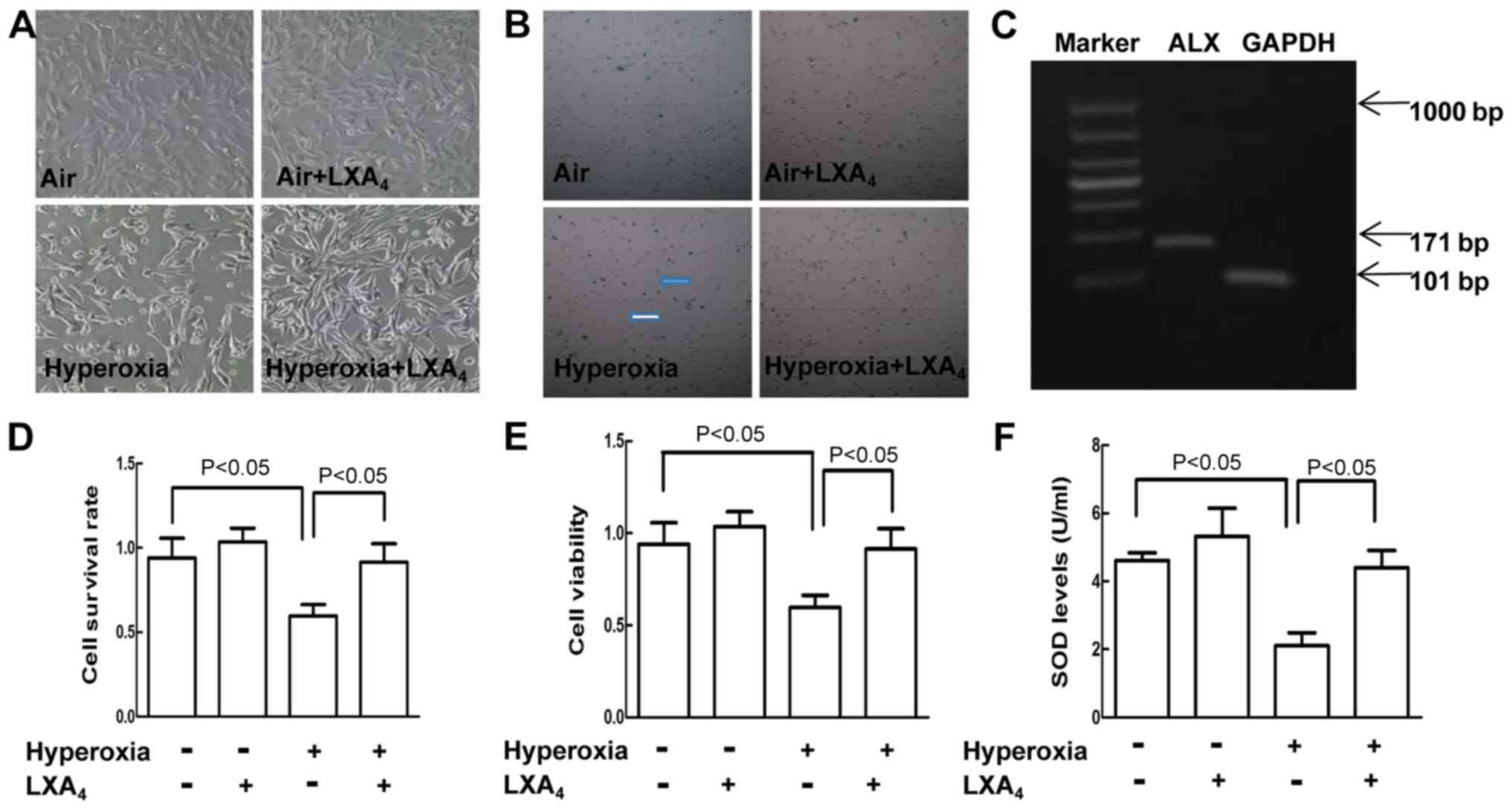Lipoxin A4 Attenuates Hyperoxia Induced Lung Epithelial Cell