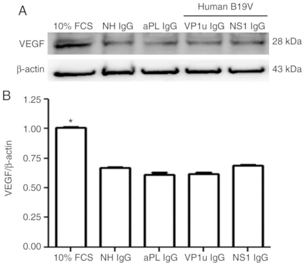 effects-of-antibodies-against-human-parvovirus-b19-on-angiogenic-signaling