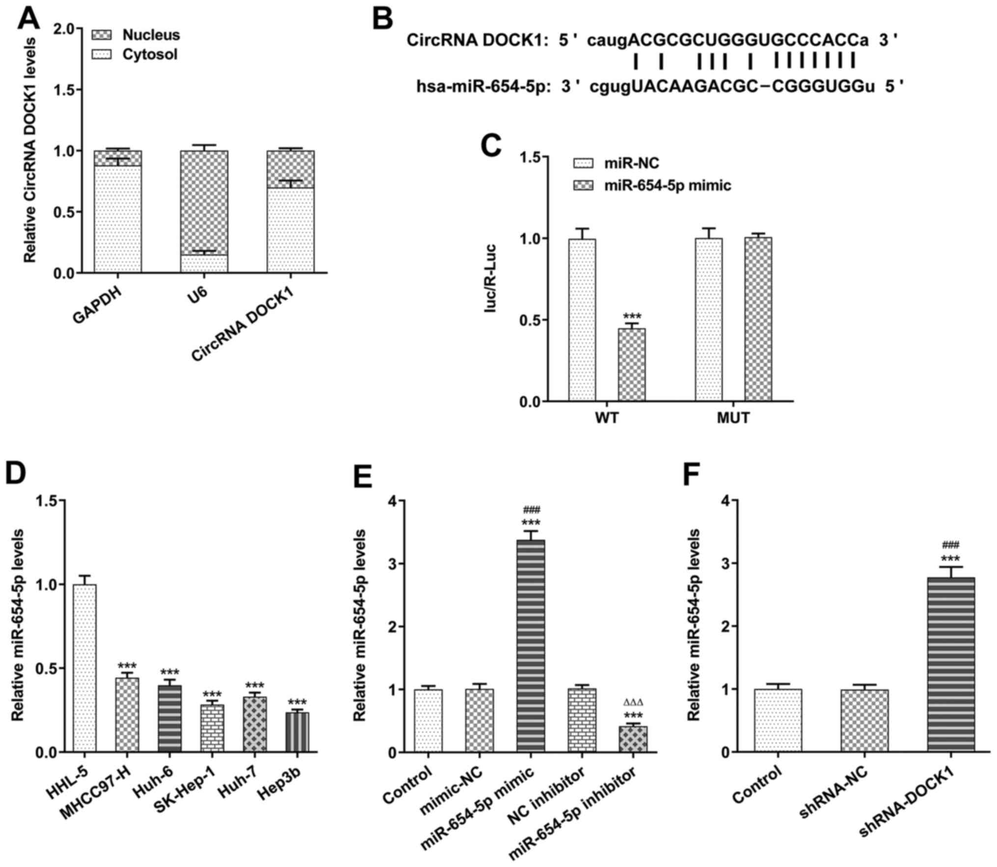 Interference With Circrna Dock1 Inhibits Hepatocellular Carcinoma Cell Proliferation Invasion
