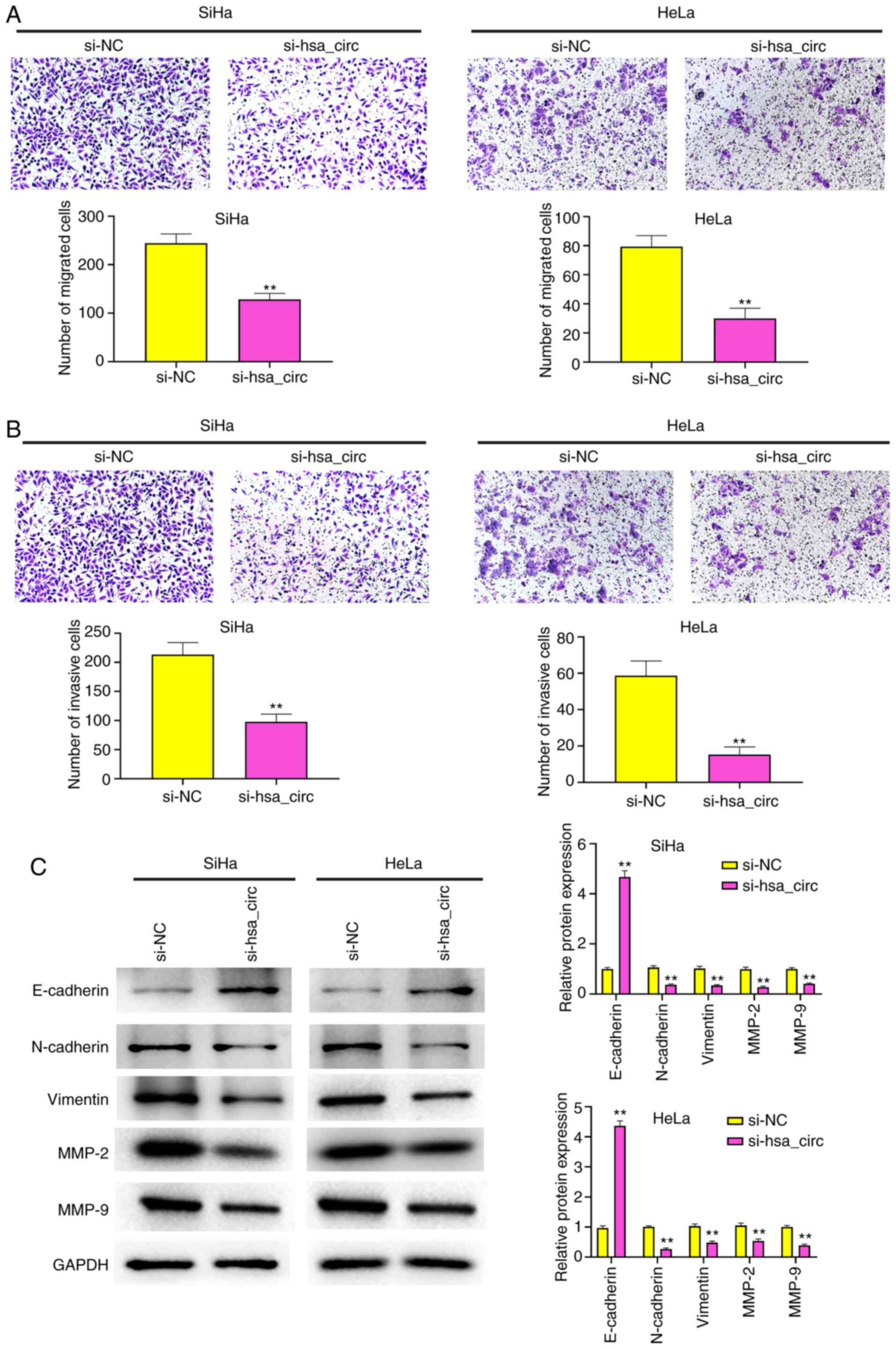 Epigenetic silencing of TCEAL7 (Bex4) in ovarian cancer