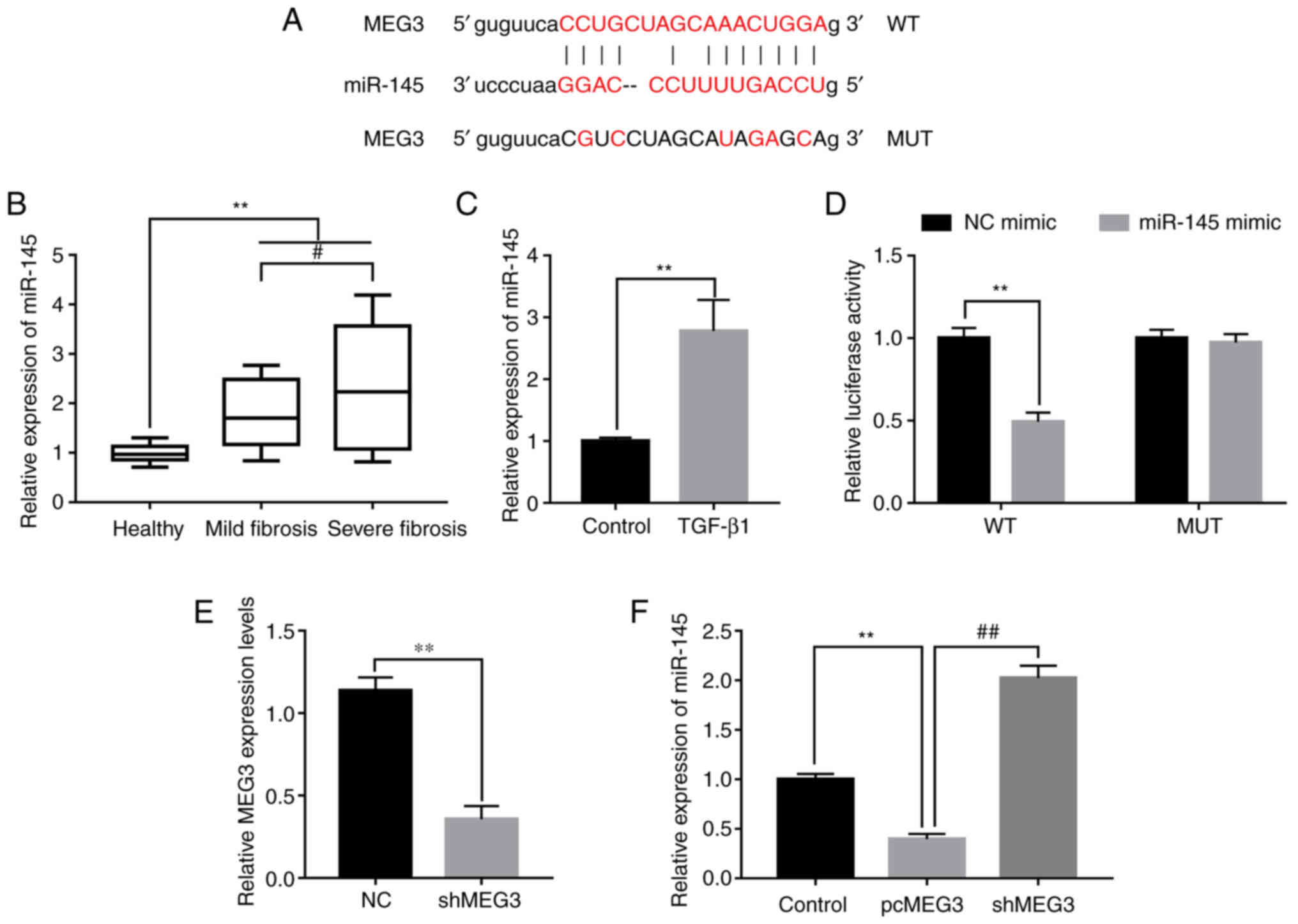 lncRNA MEG3 modulates hepatic stellate cell activation by sponging 