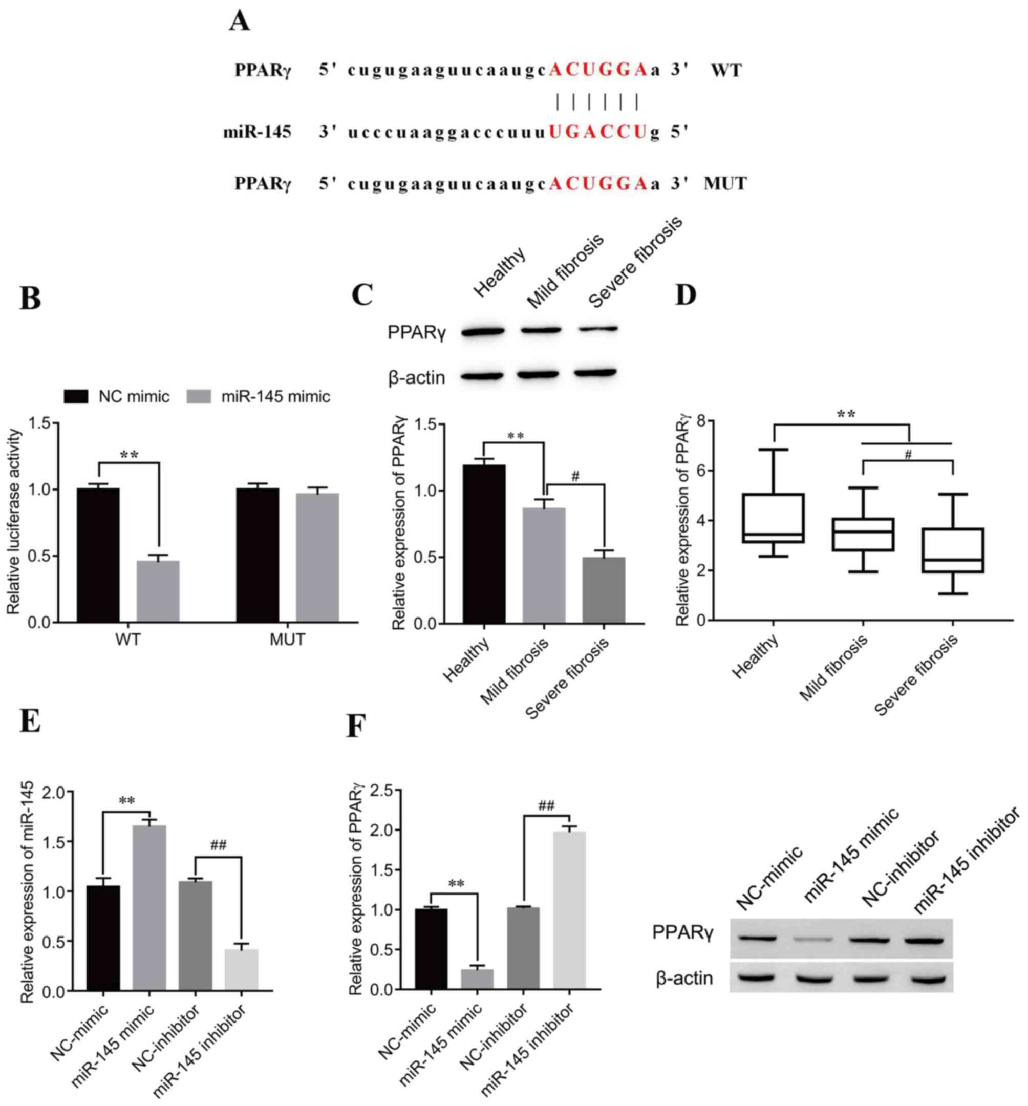 lncRNA MEG3 modulates hepatic stellate cell activation by sponging 