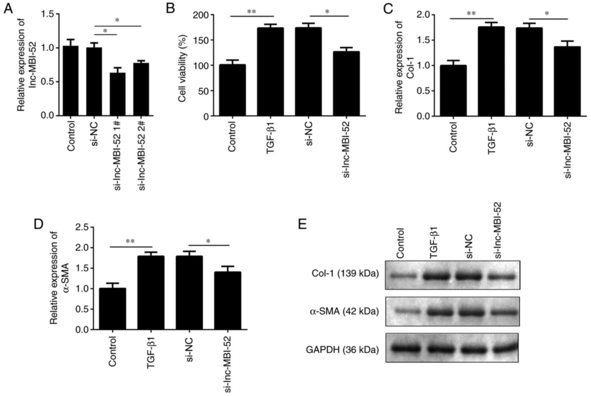 Long non‑coding RNA MBI‑52 inhibits the development of liver 