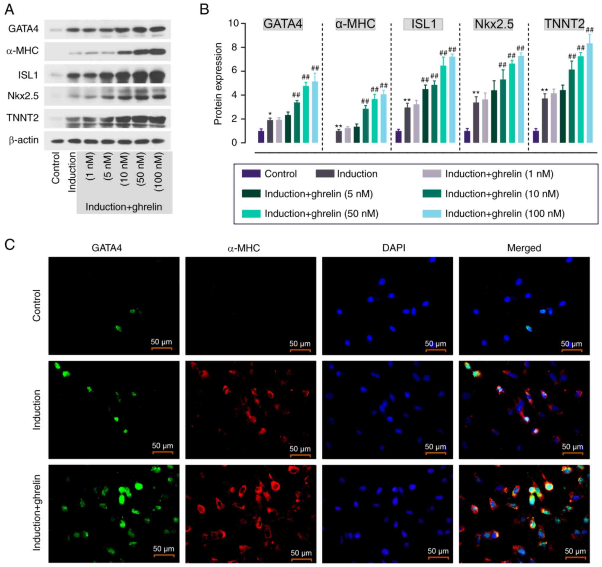 Ghrelin promotes cardiomyocyte differentiation of adipose tissue ...
