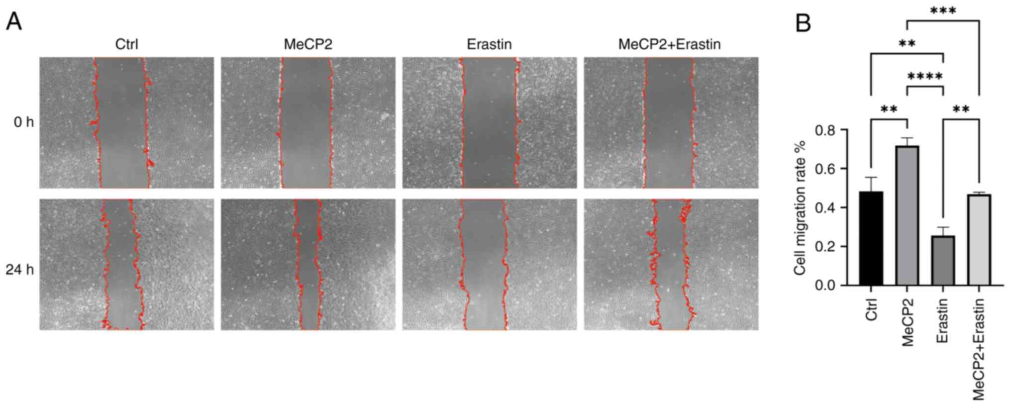 Erastin modulates ARPE-19 cell
migration. Cell migration was quantified using the wound healing
assay. (A) Representative wound healing assays showing (B)
migration of ARPE-19 cells treated with MeCP2 (100 ng/ml, 24 h),
Erastin (10 µM, 24 h), or a combination of MeCP2 (100 ng/ml, 24 h)
and Erastin (10 µM, 24 h). Magnification, ×40. **P<0.01
(P=0.0012, MeCP2 vs. control; P=0.0015, Erastin vs. control;
P=0.0023, Erastin vs. MeCP2 + Erastin), ***P<0.001 (P=0.0008,
MeCP2 vs. MeCP2 + Erastin), ****P<0.0001 (MeCP2 vs. Erastin).
Data represent three independent experiments (n=3). MeCP2,
methyl-CpG binding protein 2.