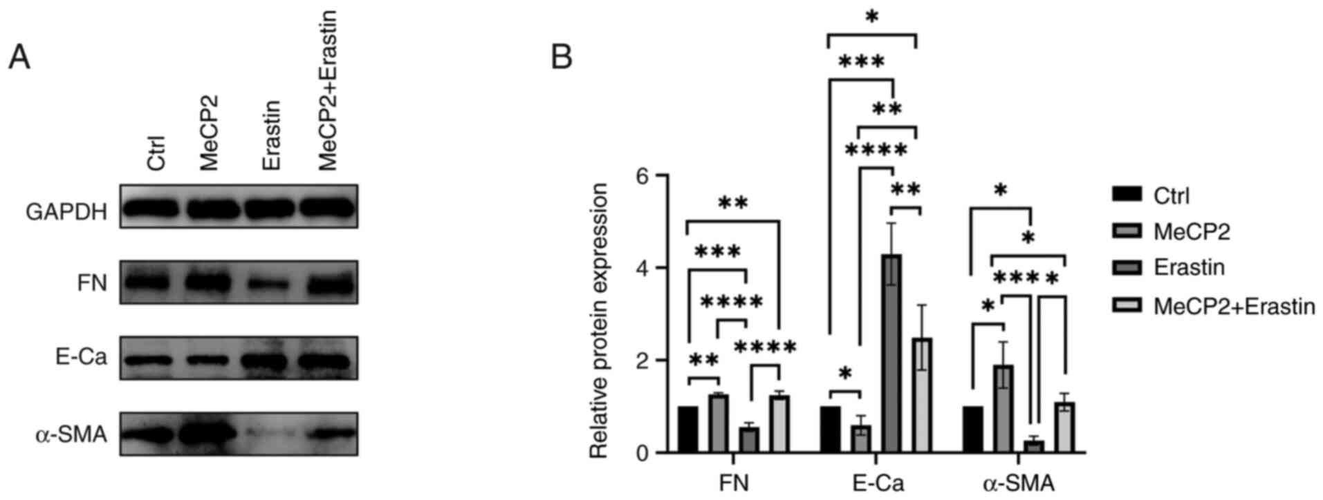Effect of ferroptosis on
MeCP2-Regulated EMT in ARPE-19 Cells. Cells were treated separately
with MeCP2 (100 ng/ml, 24 h), Erastin (10 µM, 24 h) and a
combination of MeCP2 (100 ng/ml, 24 h) and Erastin (10 µM, 24 h).
(A and B) Western blot analysis was performed to examine the
expression patterns of EMT-associated proteins, including FN, α-SMA
and E-cadherin. Blots were probed with anti-FN (1:3,000),
anti-α-SMA (1:1,000), anti-E-cadherin (1:3,000) and anti-GAPDH
(1:10,000), with GAPDH as the loading control. Statistical
significance compared with the control group: *P<0.05,
**P<0.01, ***P<0.001, ****P<0.0001 (FN: P=0.0056, MeCP2
vs. control; P=0.0002, Erastin vs. control; P=0.0087, MeCP2 +
Erastin vs. control; P<0.0001, MeCP2 vs. Erastin, Erastin vs.
MeCP2 + Erastin. E-Ca: P=0.0287, MeCP2 vs. control; P=0.0002,
Erastin vs. control; P=0.0259, MeCP2 + Erastin vs. control;
P<0.0001, MeCP2 vs. Erastin; P=0.0069, MeCP2 vs. MeCP2 +
Erastin; P=0.0092, Erastin vs. MeCP2 + Erastin. α-SMA: P=0.0154,
MeCP2 vs. control; P=0.0414, Erastin vs. control; P=0.0004, MeCP2
vs. Erastin; P=0.0271, MeCP2 vs. MeCP2 + Erastin; P=0.0233, Erastin
vs. MeCP2 + Erastin). n=3. MeCP2, methyl-CpG binding protein 2;
EMT, epithelial-mesenchymal transition; FN, fibronectin; α-SMA,
α-smooth muscle actin; E-Ca, E-cadherin.