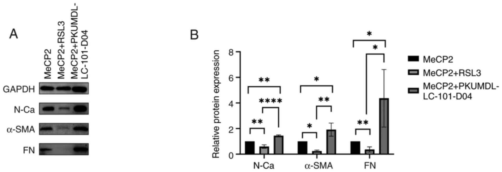 MeCP2 modulates ferroptosis-mediated
EMT in ARPE-19 cells through GPX4 Regulation. Cells were treated
separately with MeCP2 (100 ng/ml, 24 h), a combination of MeCP2
(100 ng/ml, 24 h) and RSL3 (0.5 µM, 24 h) and a combination of
MeCP2 (100 ng/ml, 24 h) and PKUMDL-LC-101-D04 (65 µM, 24 h). (A)
Representative western blot of (B) EMT-associated proteins (FN,
α-SMA, and N-cadherin) in ARPE-19 cells following GPX4 activation
and inhibition. *P<0.05, **P<0.01, ****P<0.0001 vs.
control. (N-Ca: P=0.0029, MeCP2 vs. MeCP2 + RSL3; P=0.0018, MeCP2
vs. MeCP2 + PKUMDL-LC-101-D04; P<0.0001, MeCP2 + RSL3 vs. MeCP2
+ PKUMDL-LC-101-D04. α-SMA: P=0.0482, MeCP2 vs. MeCP2 + RSL3;
P=0.0219, MeCP2 vs. MeCP2 + PKUMDL-LC-101-D04; P=0.0012, MeCP2 +
RSL3 vs. MeCP2 + PKUMDL-LC-101-D04. FN: P=0.0056, MeCP2 vs. MeCP2 +
RSL3; P=0.0448, MeCP2 vs. MeCP2 + PKUMDL-LC-101-D04; P=0.0221,
MeCP2 + RSL3 vs. MeCP2 + PKUMDL-LC-101-D04). n=3. MeCP2, methyl-CpG
binding protein 2; EMT, epithelial-mesenchymal transition; GPX4,
glutathione peroxidase 4; FN, fibronectin; α-SMA, α-smooth muscle
actin; N-Ca, N-cadherin.