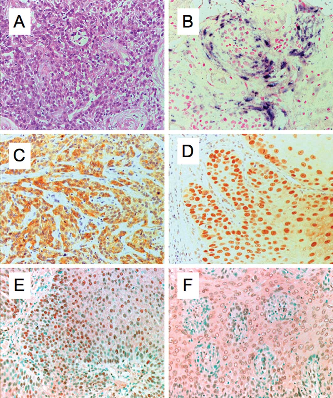 hpv lung cancer immunohistochemistry