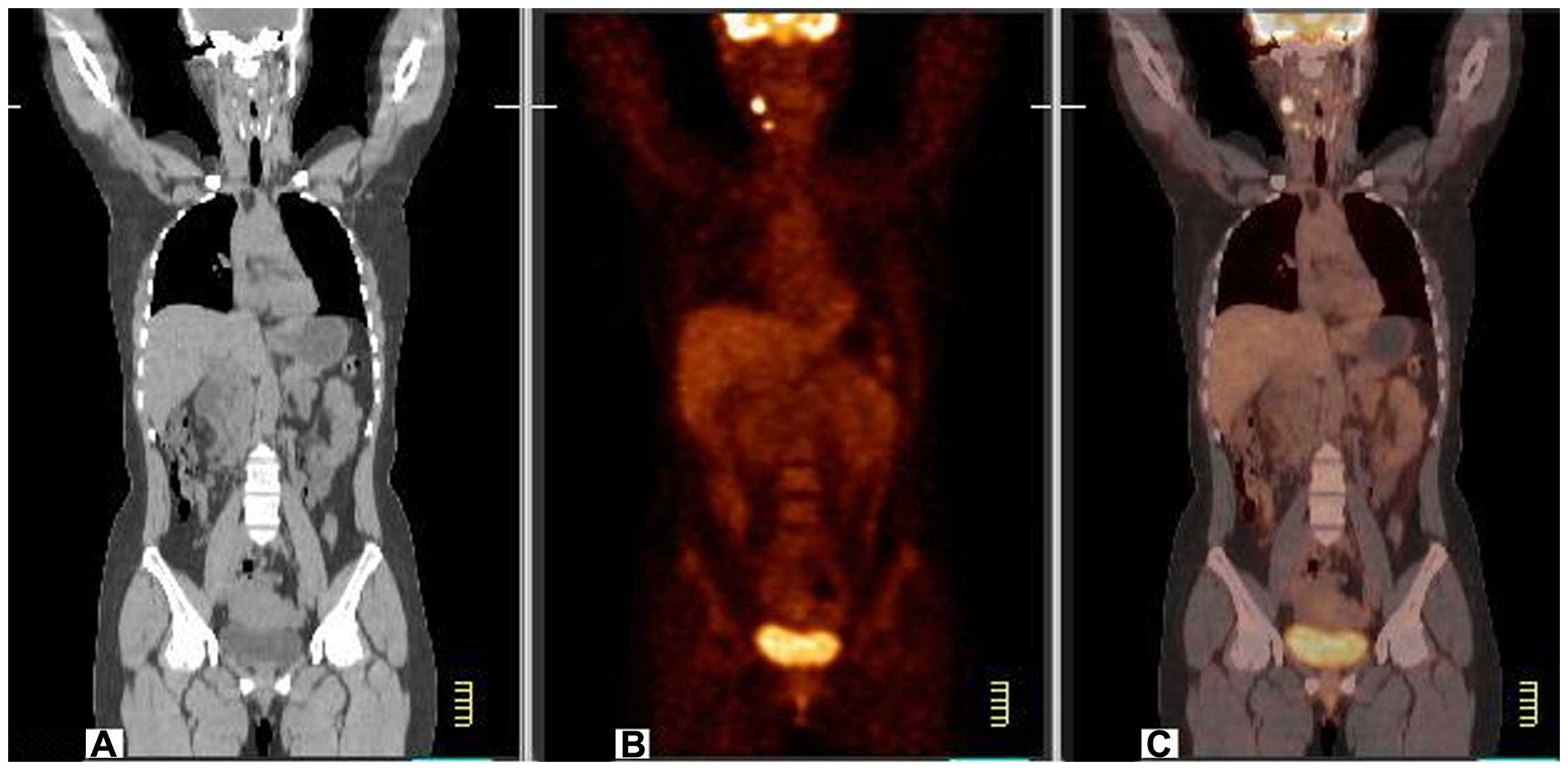 Что можно перед пэт кт с контрастом. Positron emission tomography (Pet) scans. ПЭТ кт Pet CT.