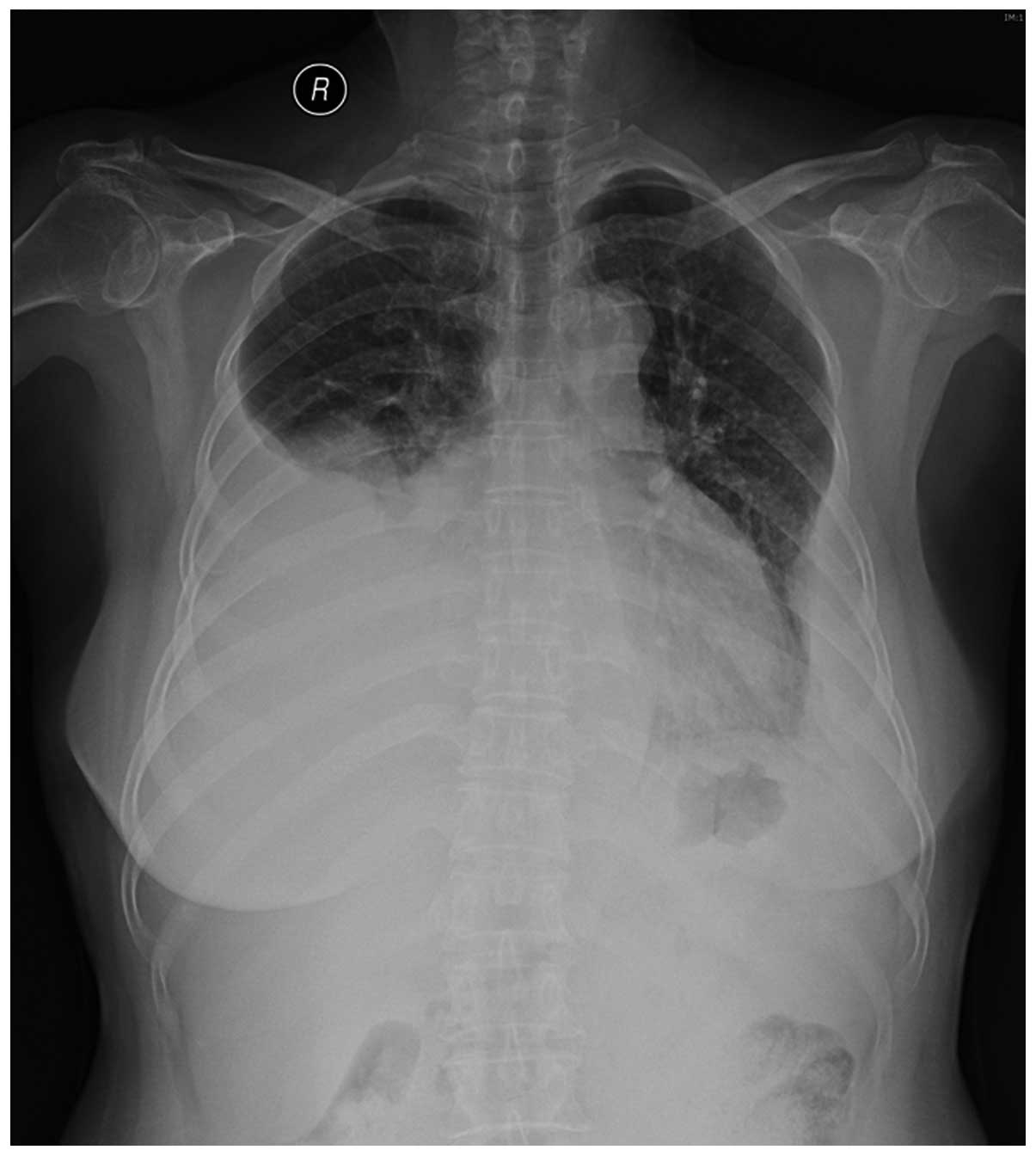 Chest | SpringerLink