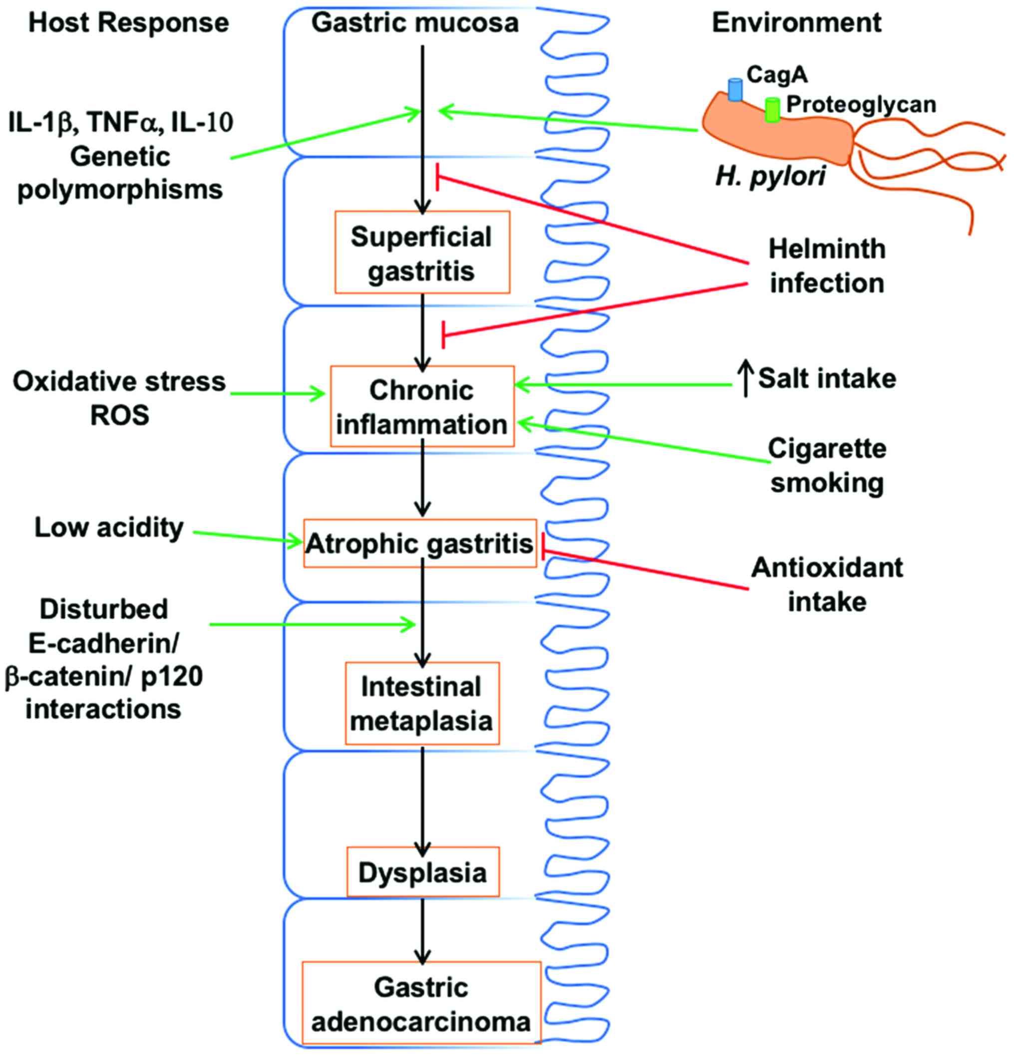 gastric cancer h pylori