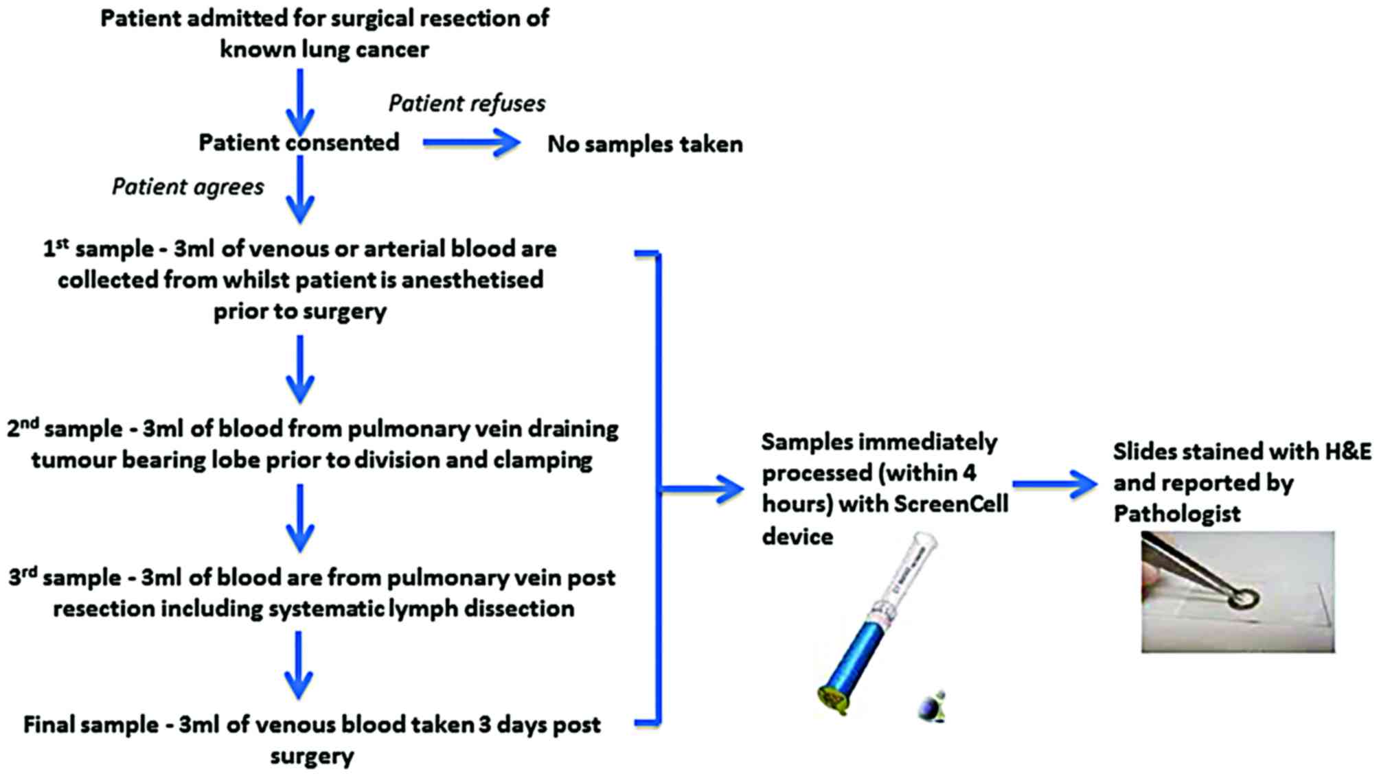 Pathophysiology Of Lung Cancer In Flow Chart
