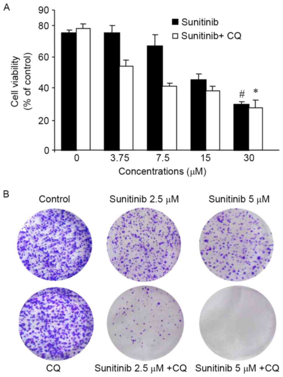 Chloroquine potentiates the anticancer effect of sunitinib 