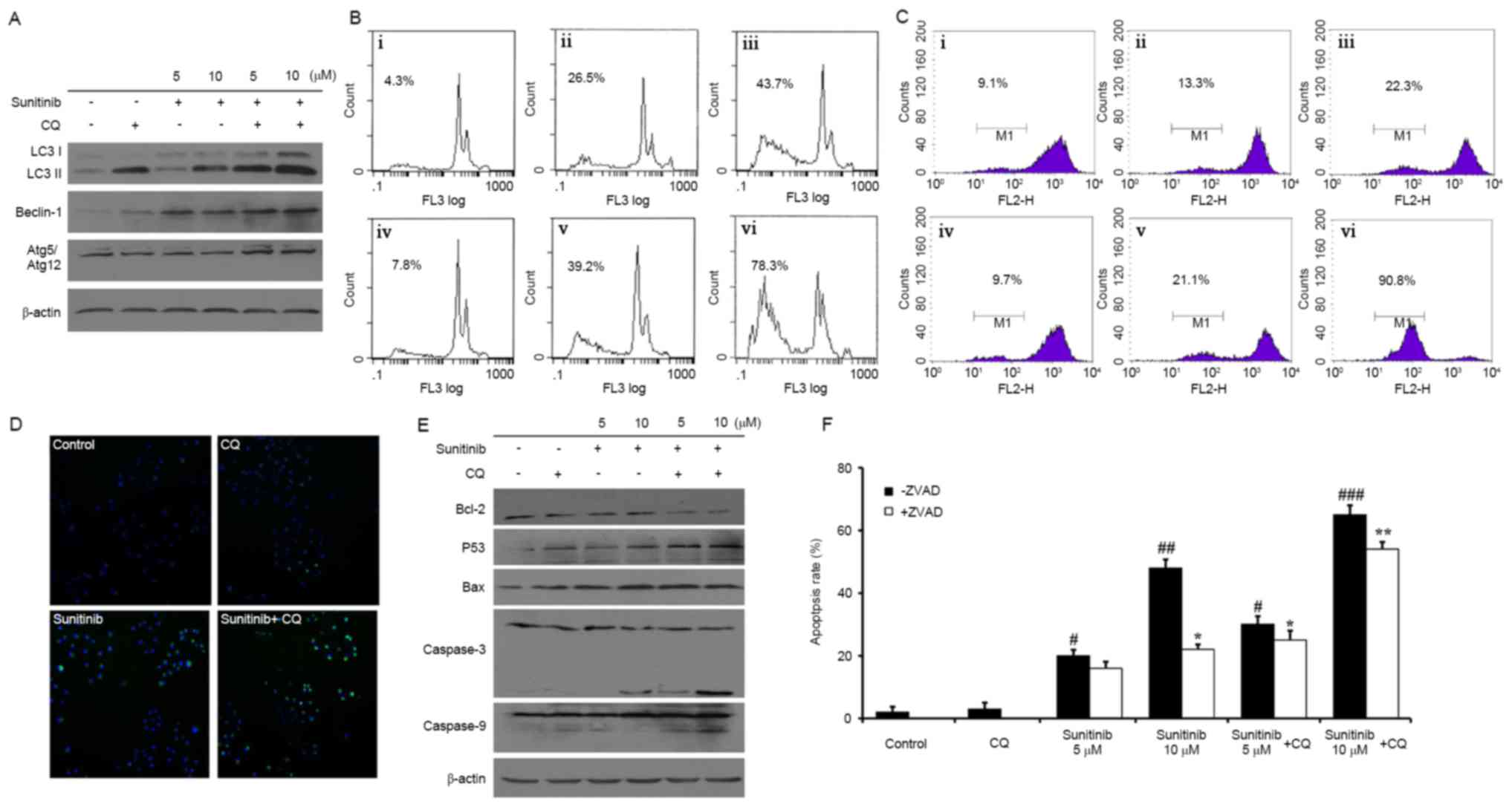 Chloroquine potentiates the anticancer effect of sunitinib 