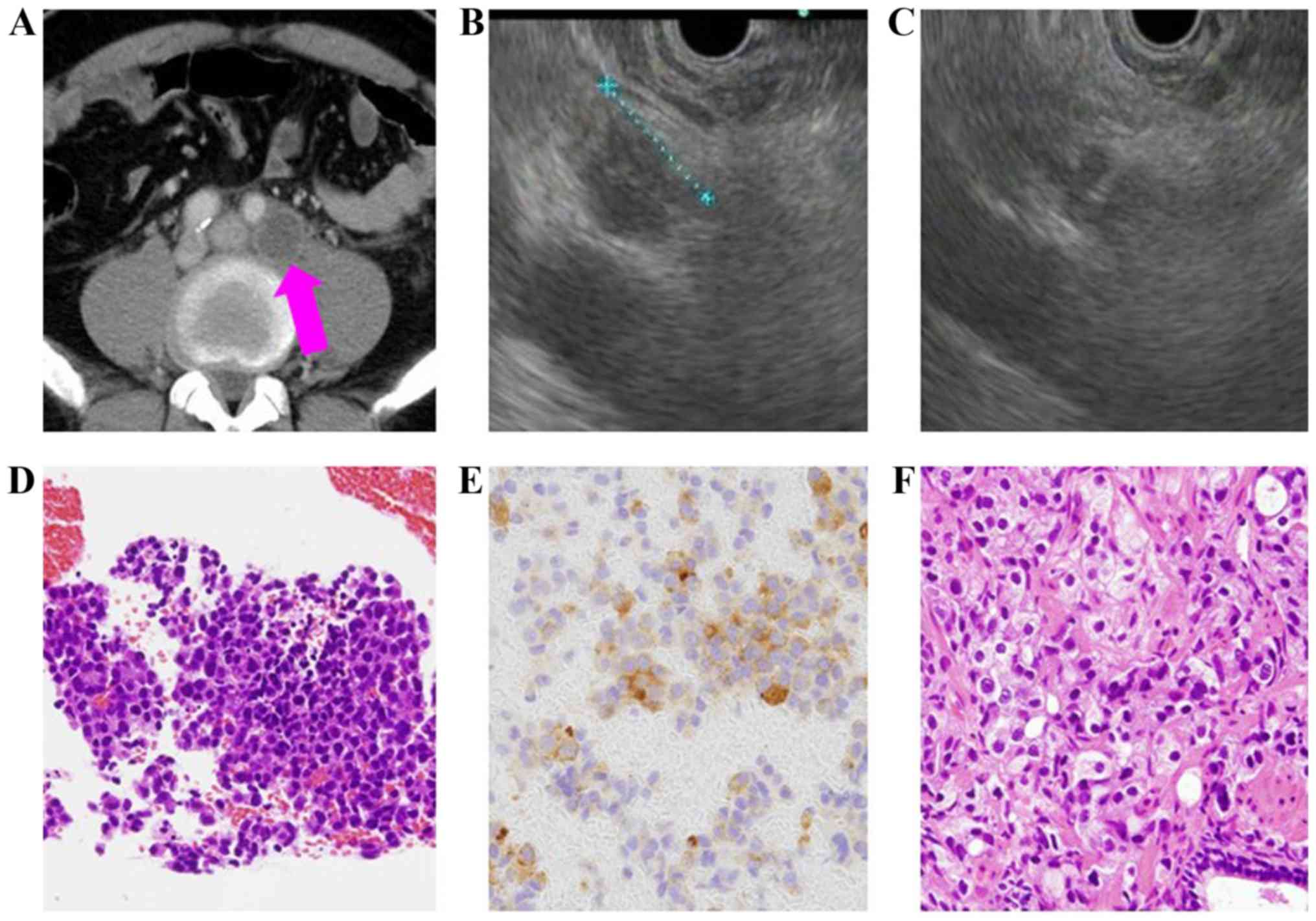 fine needle aspiration prostate dog leziunea prostatitei